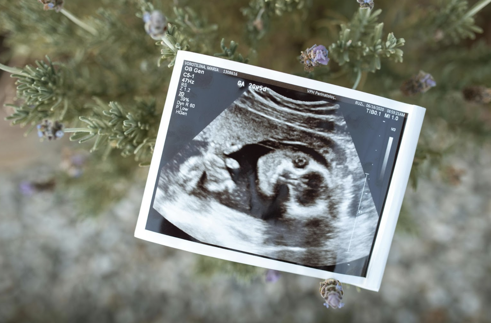 Frozen vs. Fresh Embryo Transfer in Surrogacy: Which Is Better?