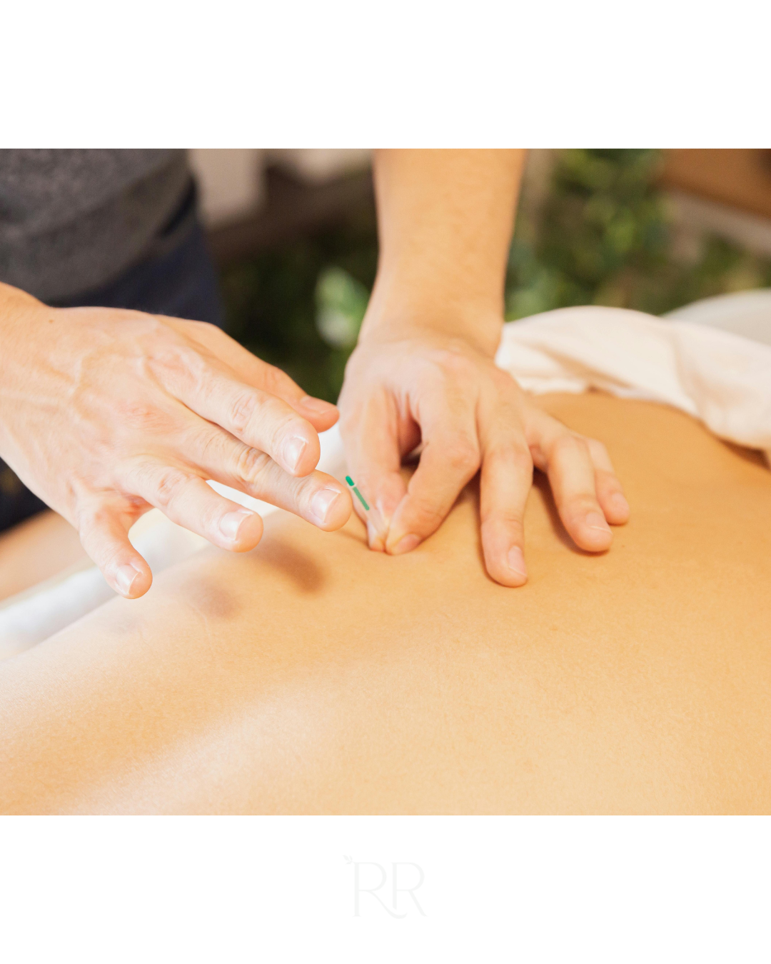 Supporting You During and After Cancer Treatment with Acupuncture