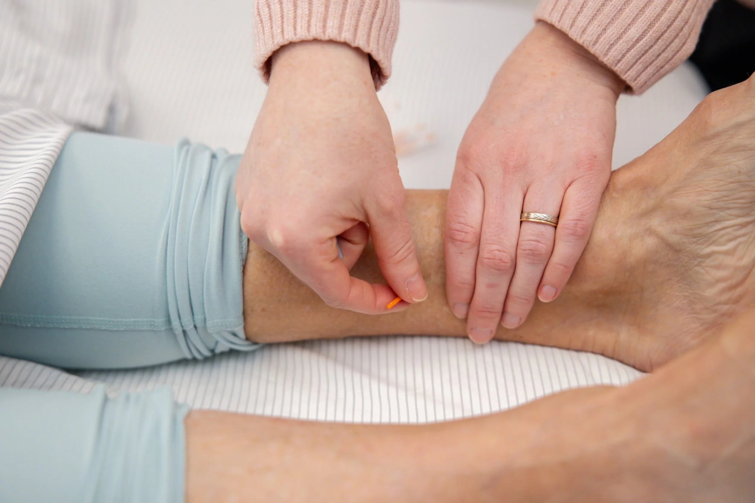 Nervous About Acupuncture Needles? Here’s What to Expect at Root To Rise 