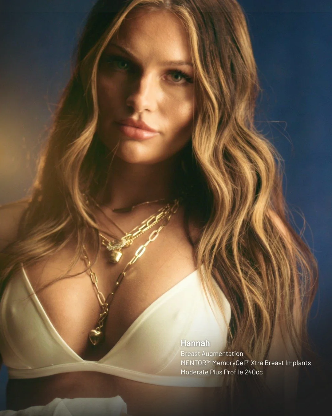 She grew up where &ldquo;natural&rdquo; was the only way. Where wanting more meant being judged.​
But Hannah never played by those rules.​
​
She knew what she liked: the shape, the curve, the confidence it gave her.​
Hannah chose what made her feel g