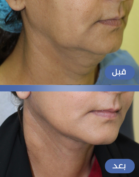 Screen Shot 2023-10-26 at 4.04.03 PM.png