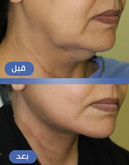 Screen Shot 2023-10-26 at 4.03.46 PM.png