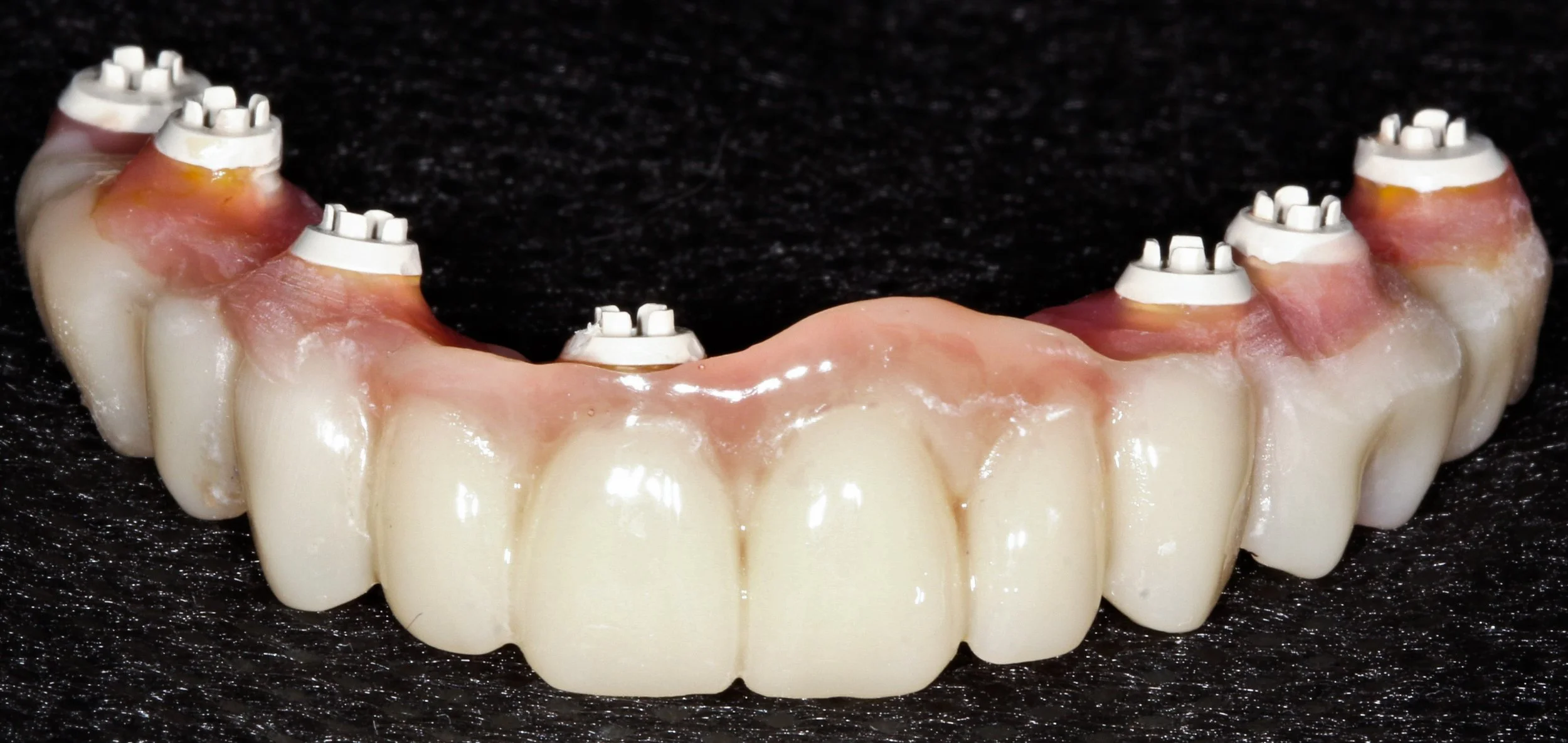 H. Madsen upper- temp prosthesis.jpg