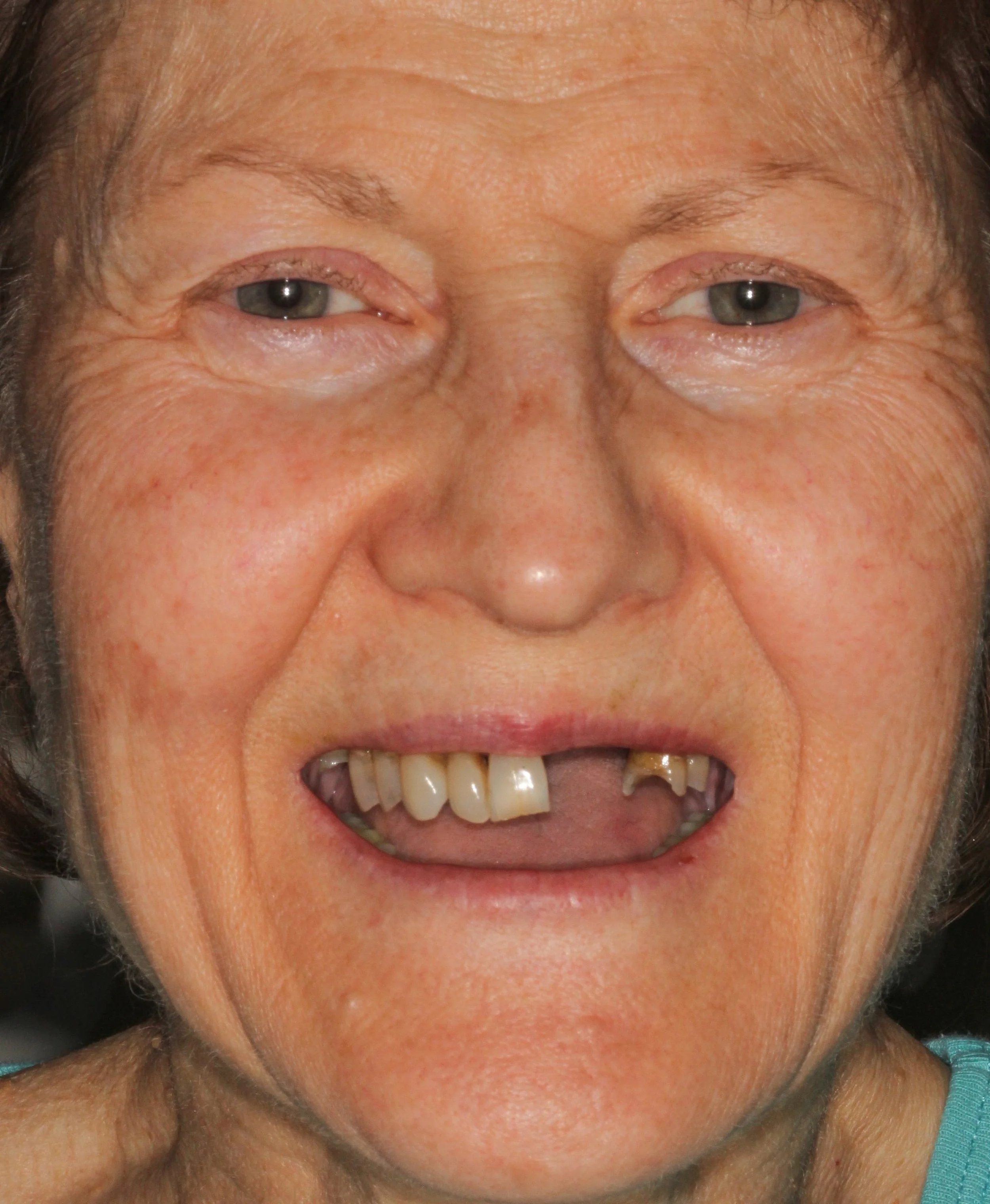 H. Madsen pre-op face.jpg