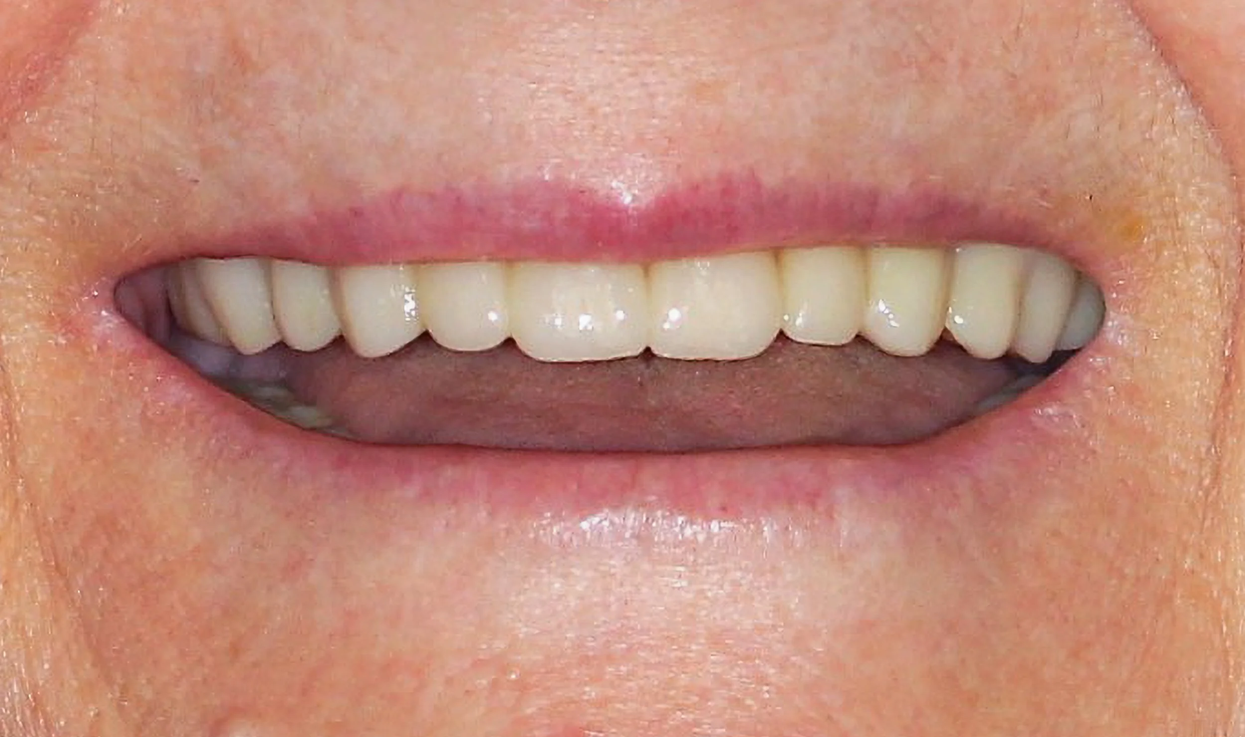 HM After Smile-1.jpg