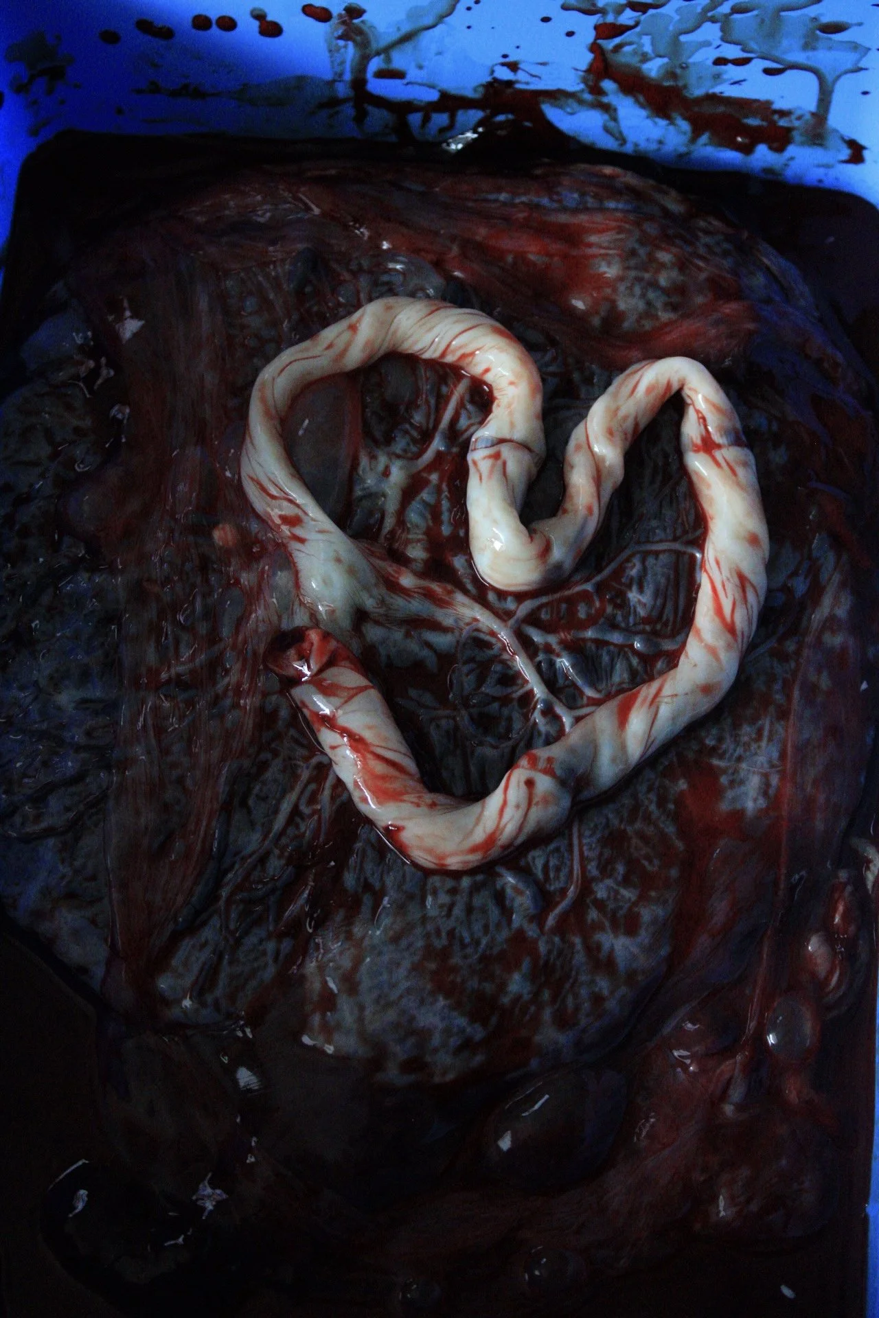 doulas doula sacramento  folsom rocklin roseville el dorado placerville birth pregnancy homebirth hospital waterbirth natural unmedicated support