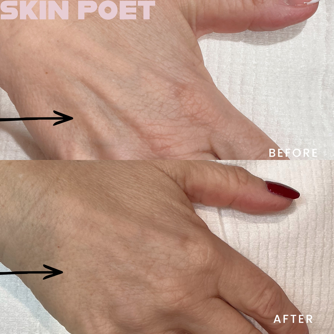 Are your hands aging you?