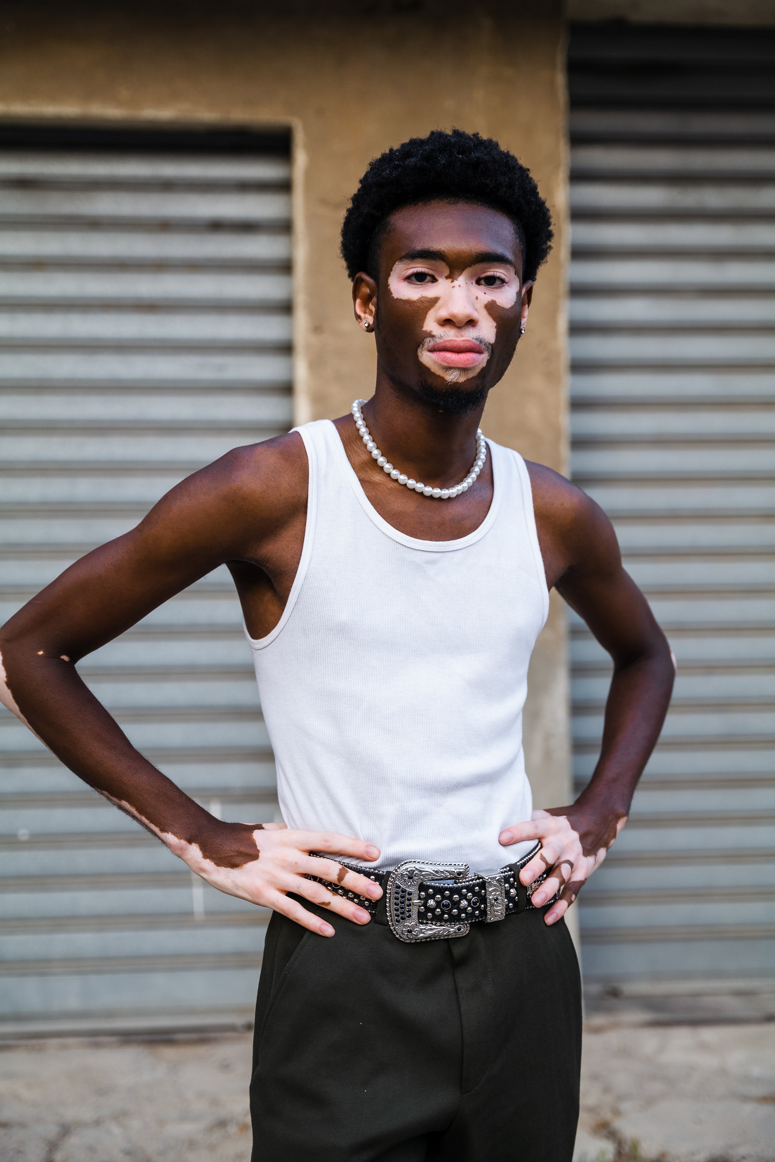 person with vitiligo, wearing a white tank top, pearl necklace, and black pants with a decorative belt, standing in front of a metal shutter.