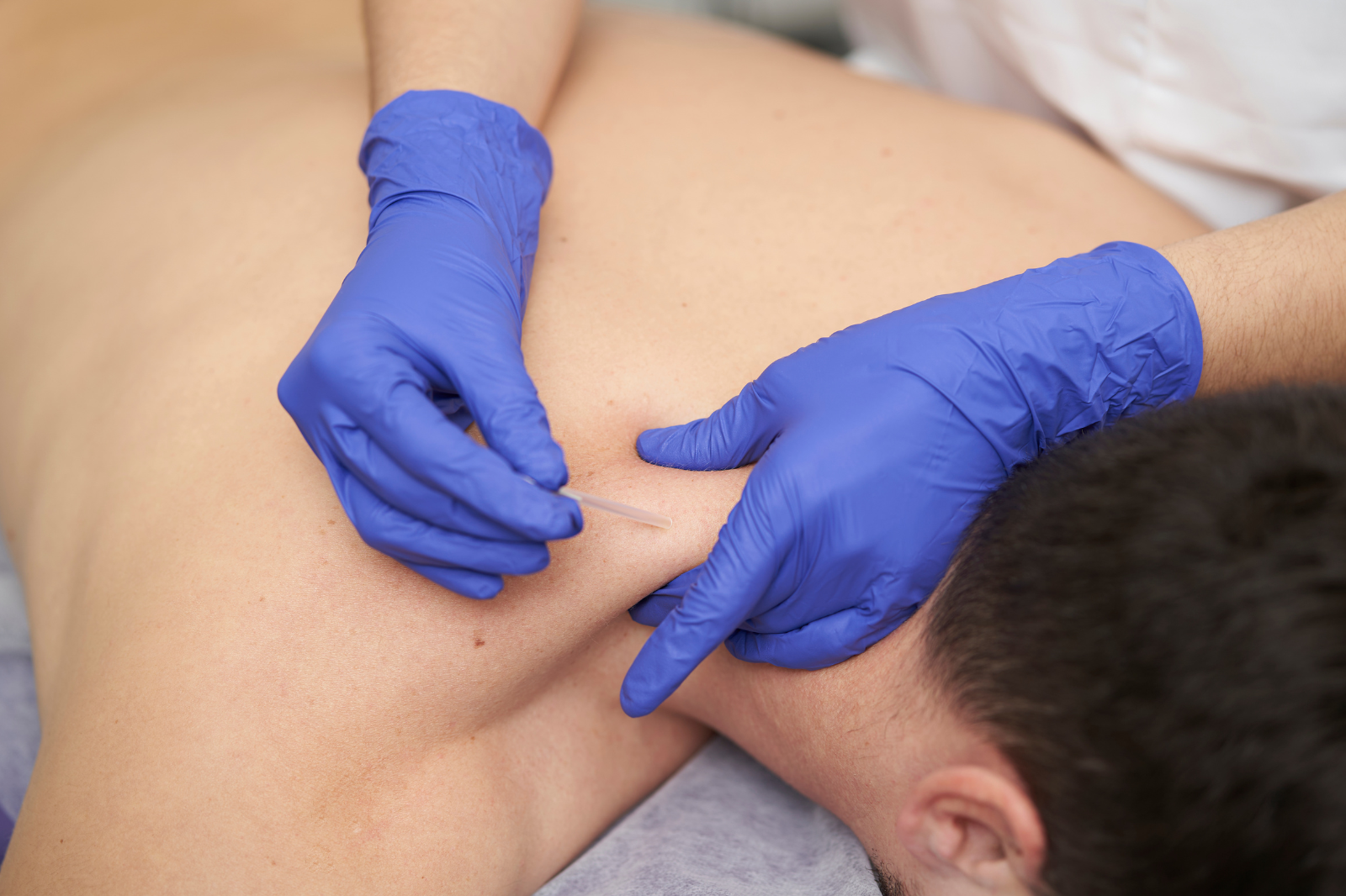 A healthcare professional wearing blue gloves administering an injection into a patient's upper arm while the patient lies on an examination table.