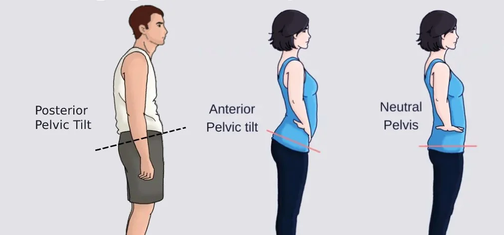 What Pelvic Tilt Do You Have?