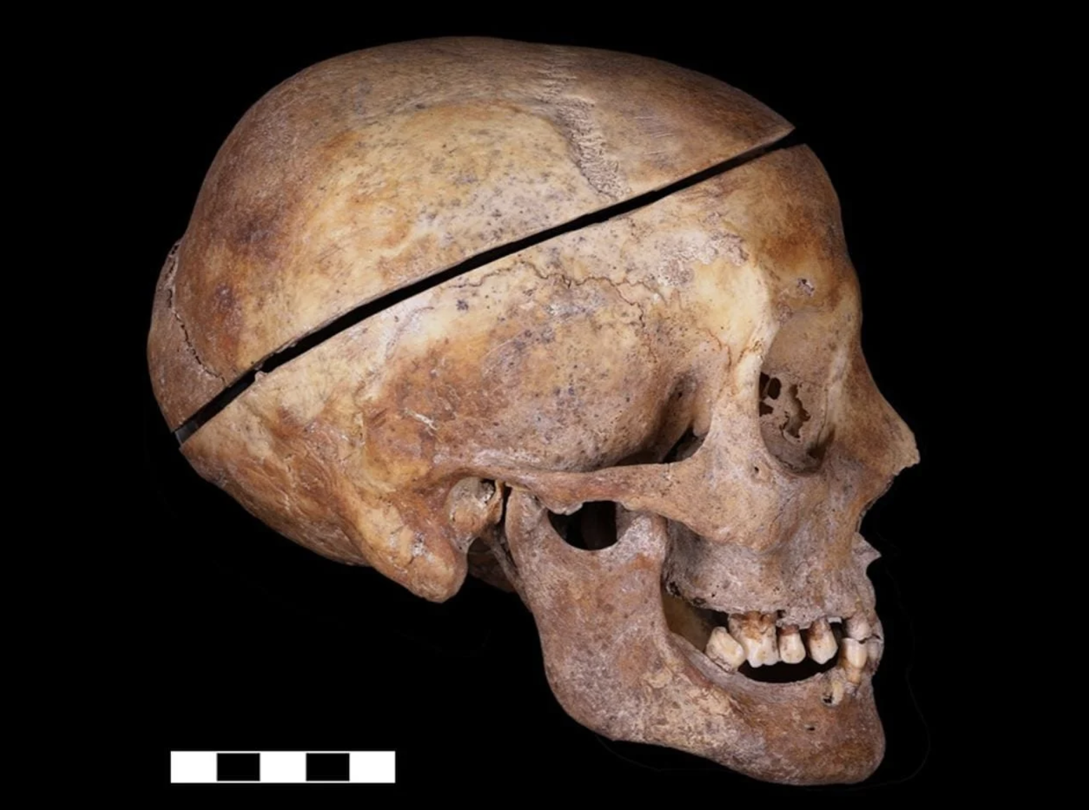 Aristocratic Embalming Practices Discovered at Château des Milandes!