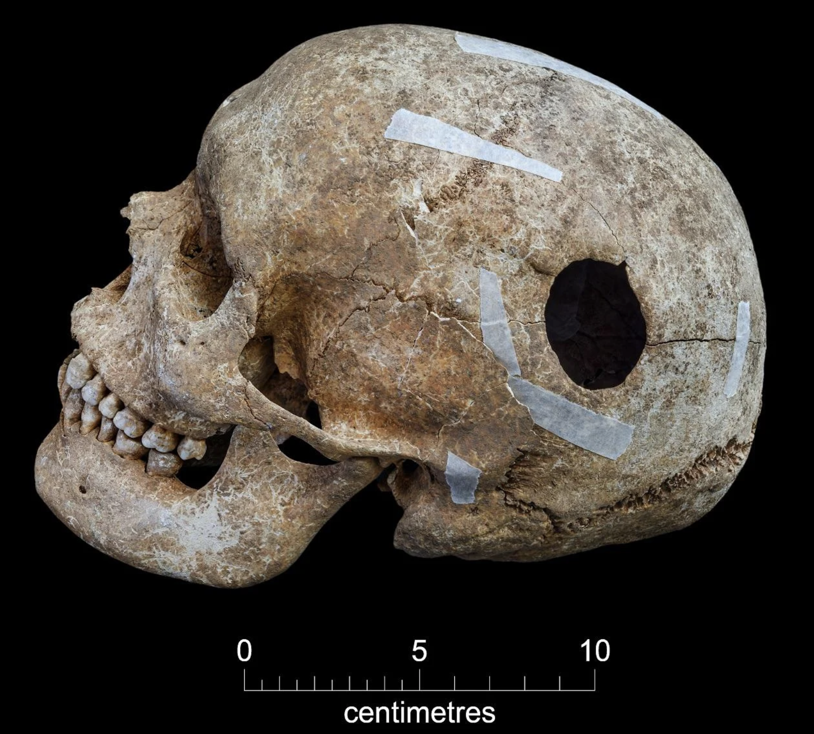 Viking Mass Grave found in Cambridge