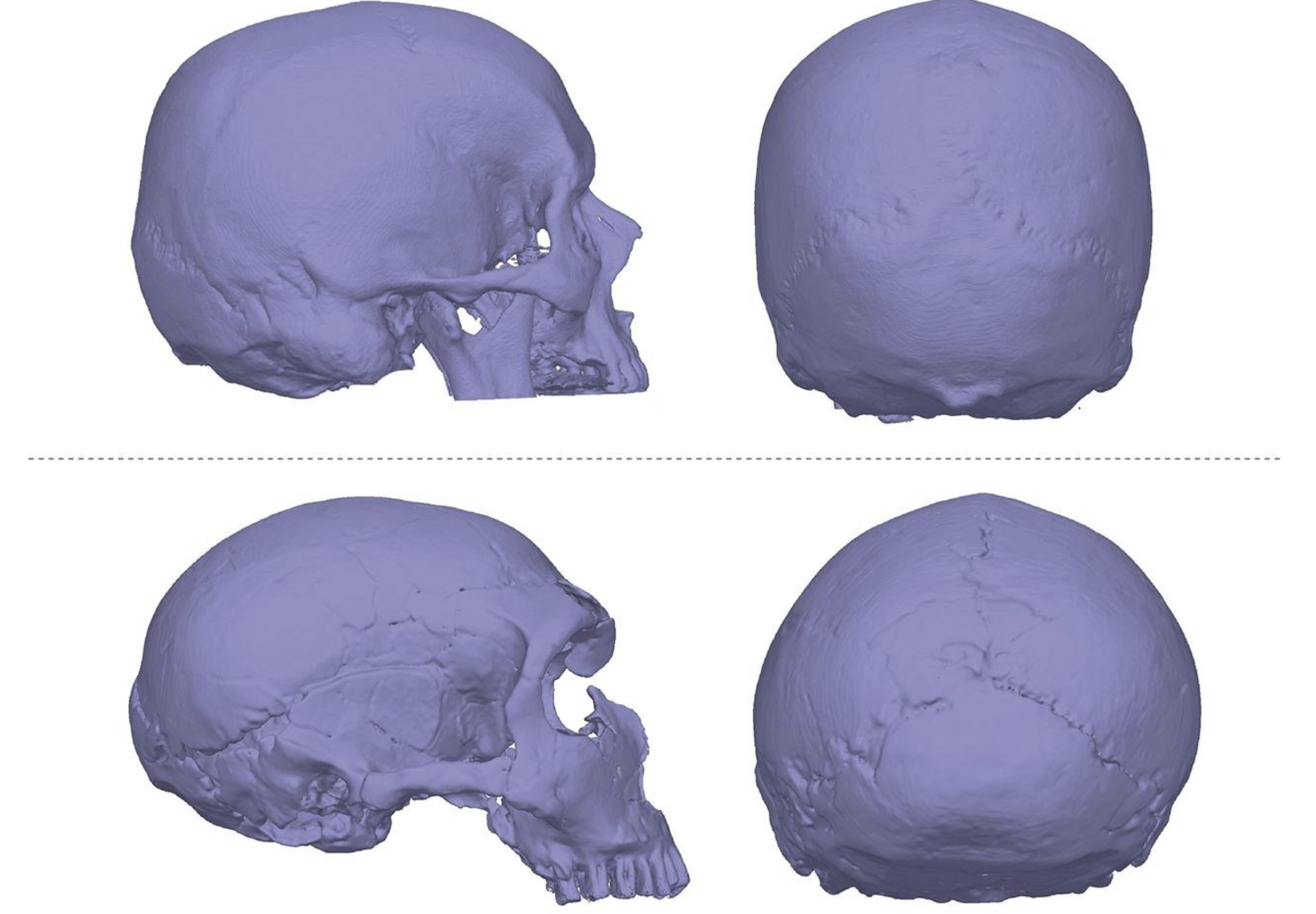 Neanderthal skull vs Homo sapiens