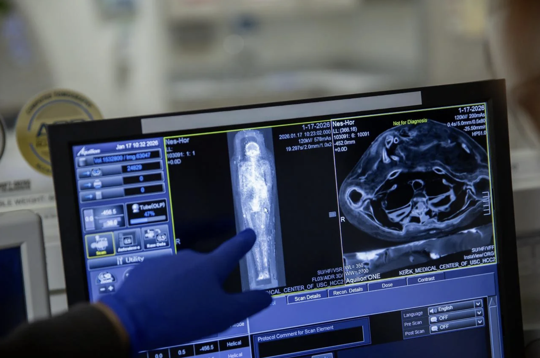 Study of Ancient Egyptian priests mummies