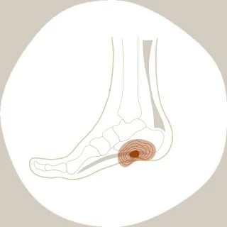 foot-pain-plantar-fasciitis.jpg