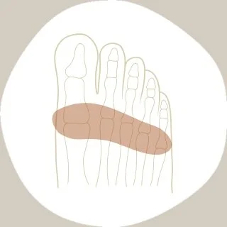 foot-pain-metatarsalgia.jpg