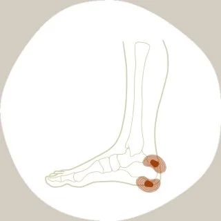 foot-heel-pain.jpg