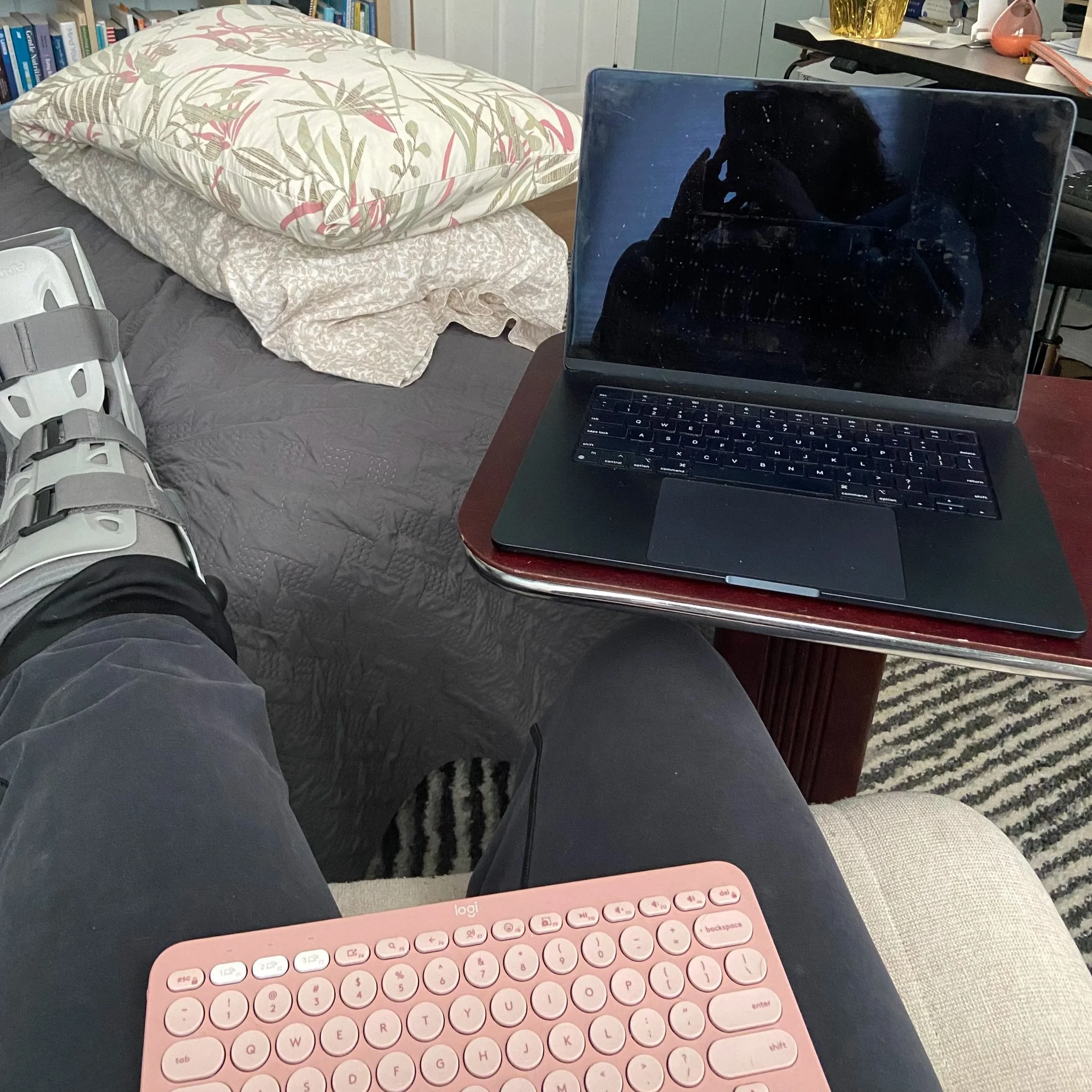 a leg in an air cast is propped on a bed