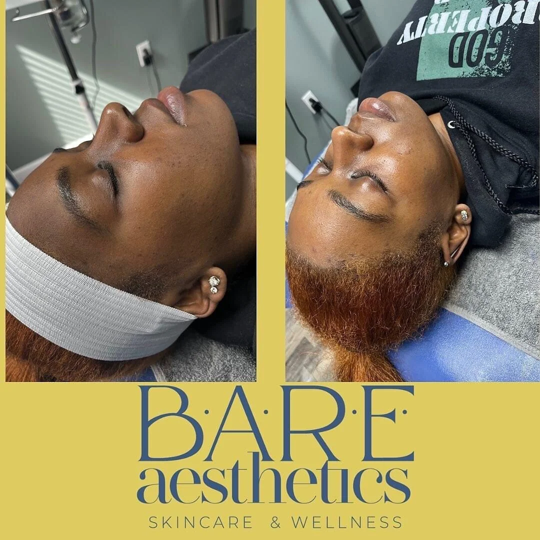 #skincare #bare #esthetician