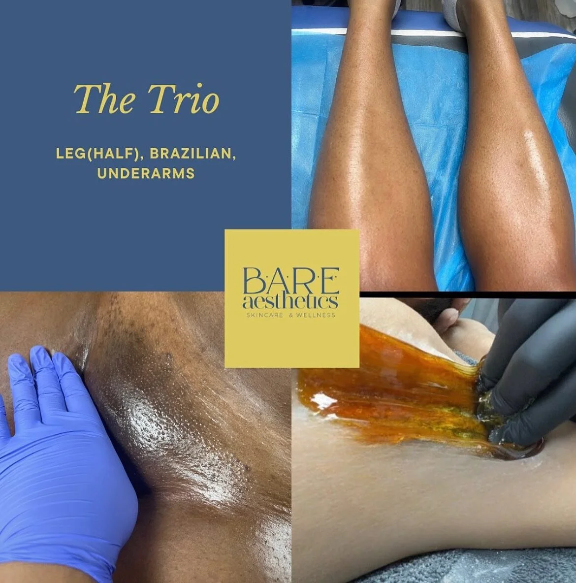 Check out the trio deal link in the bio #sugar #sugarhairremoval #sugarist #bare