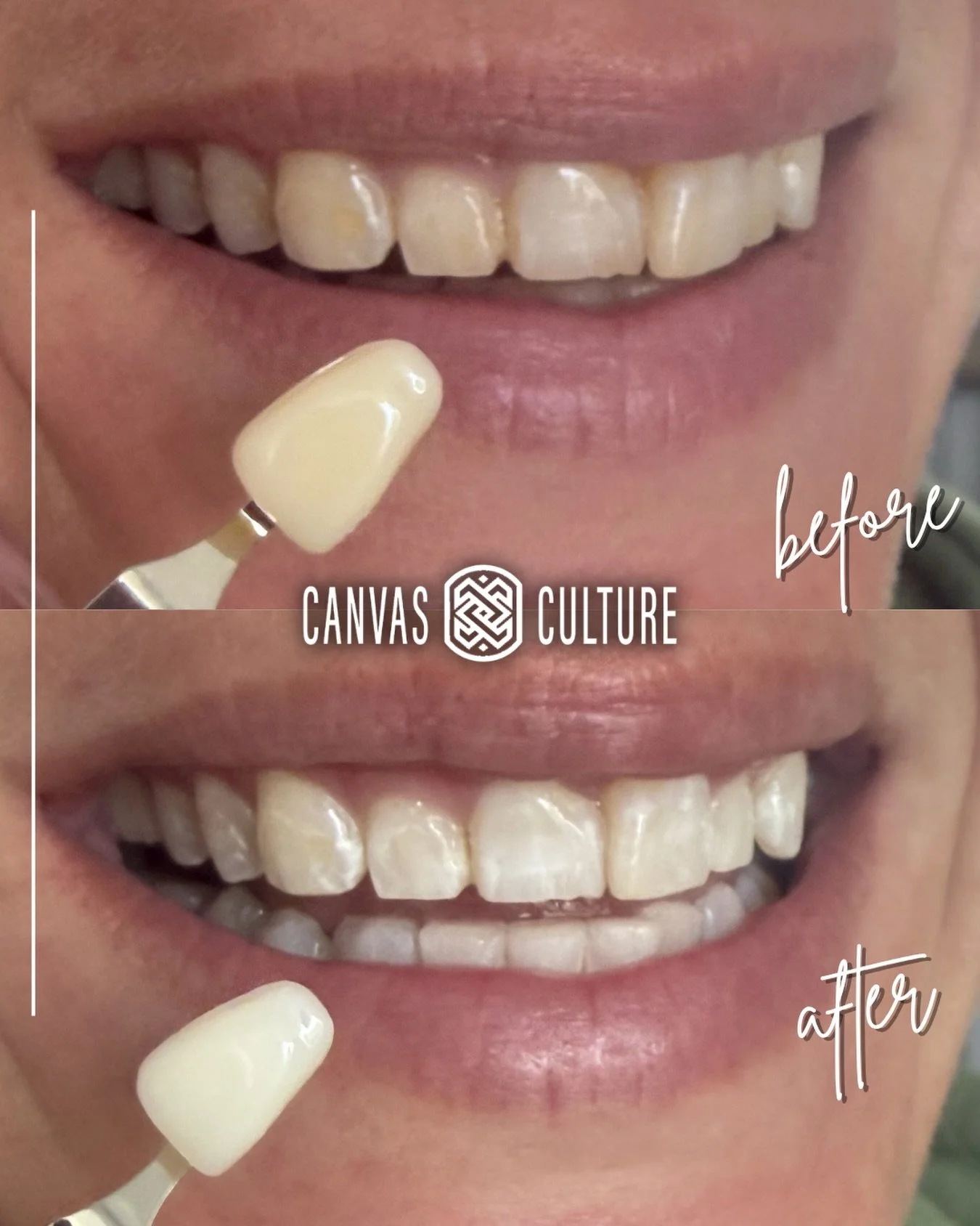 We were able to move this client about 8 shades in an hour! She was happy with the results and plans to come back to maintain!