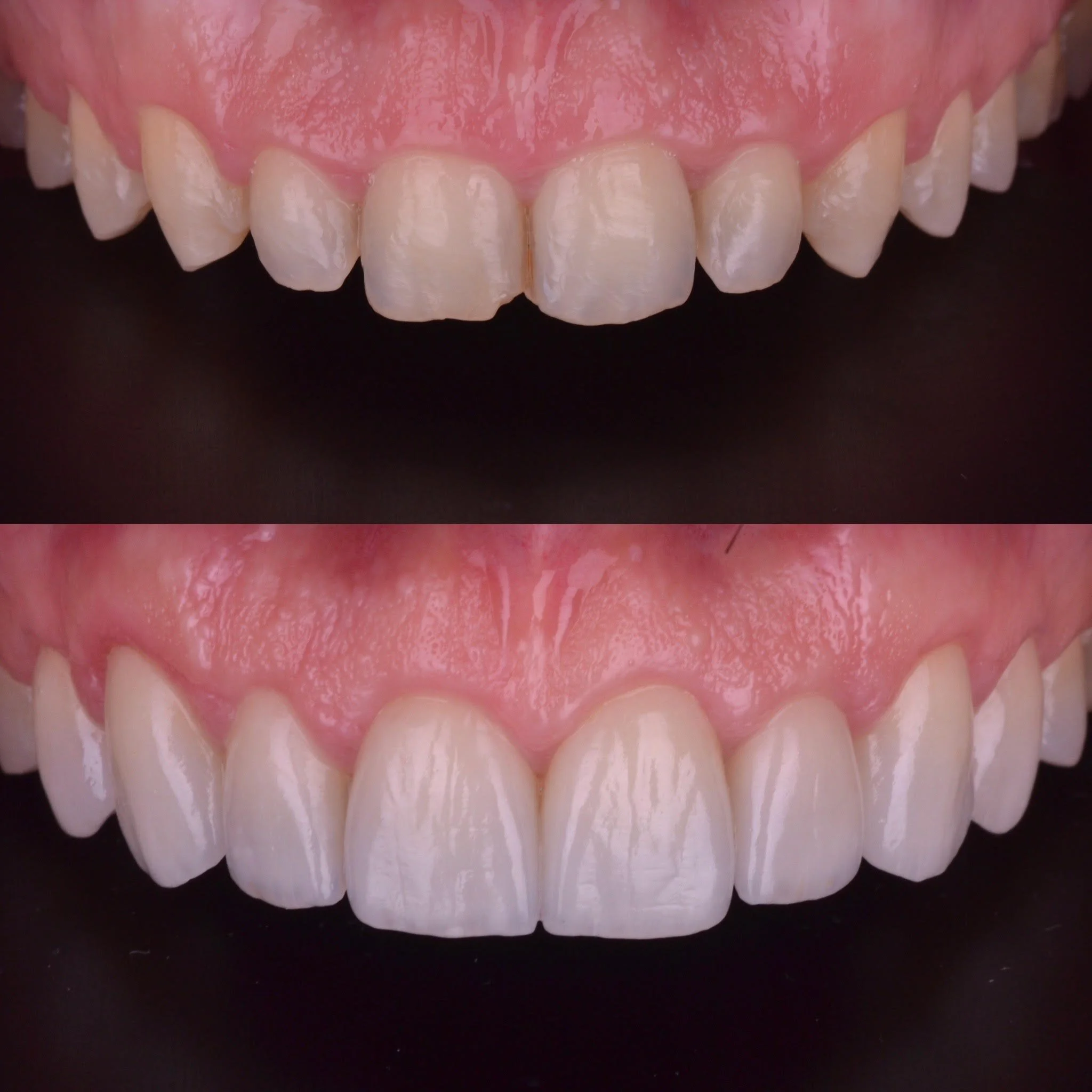 Alejandro Salazar Estancia Clínica Estética Dental — DOCTOR & COLS