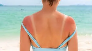 Why Some People Struggle to Tan (And Why That Matters)