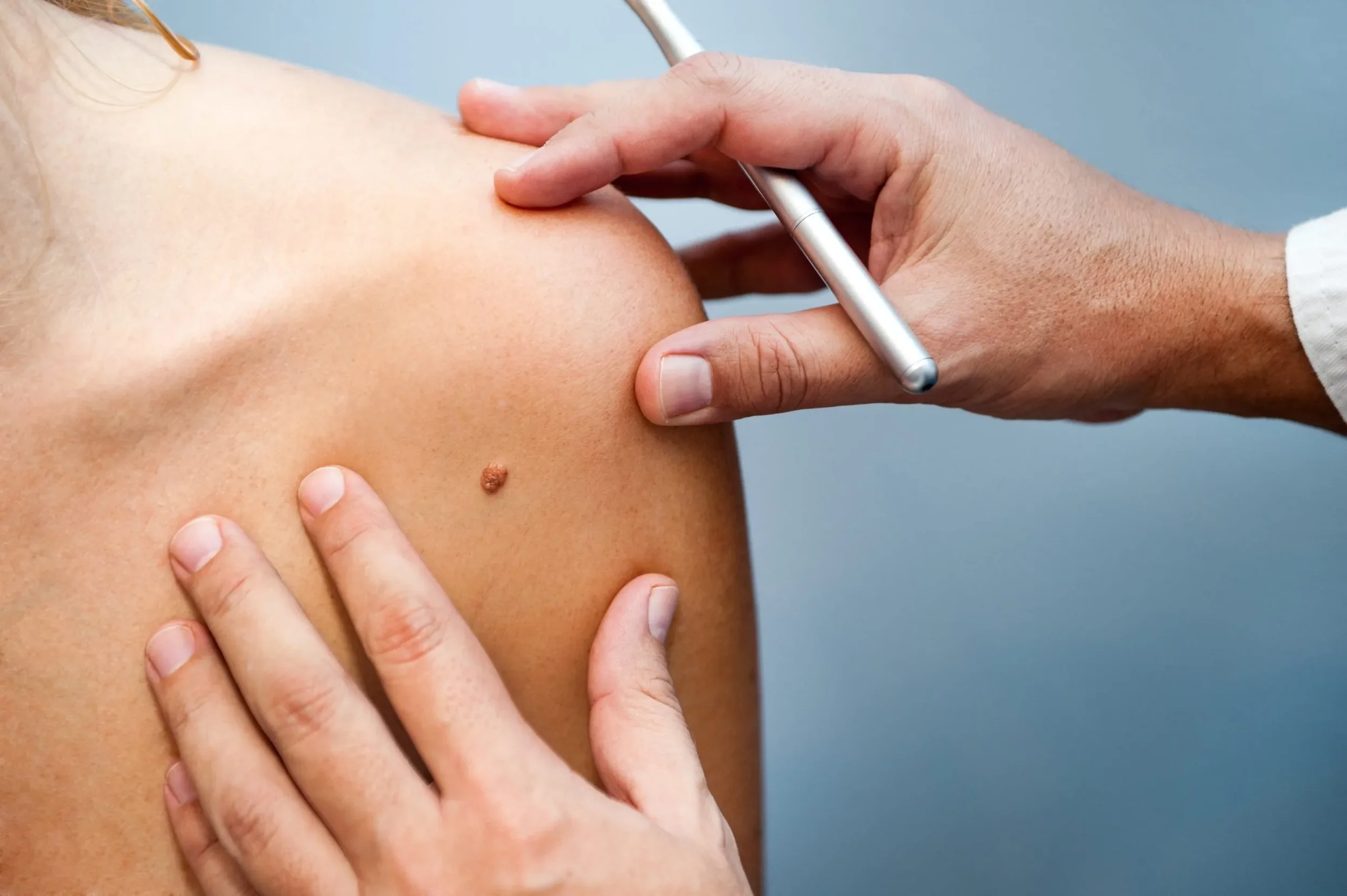 What to Expect at Your First Dermatology Visit at Summit Dermatology