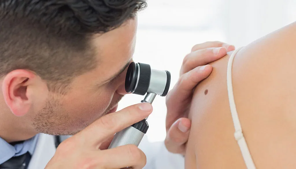 Skin Cancer Awareness Month: How to Spot Early Signs of Skin Cancer