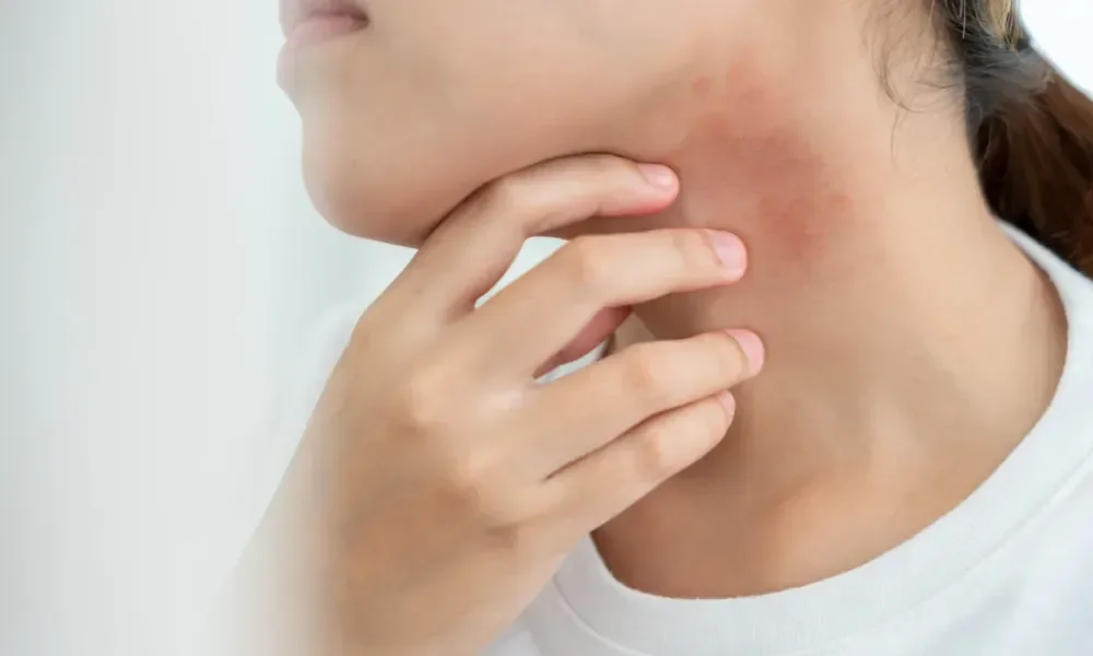 Spring Allergies and Your Skin: How to Calm Irritation and Redness