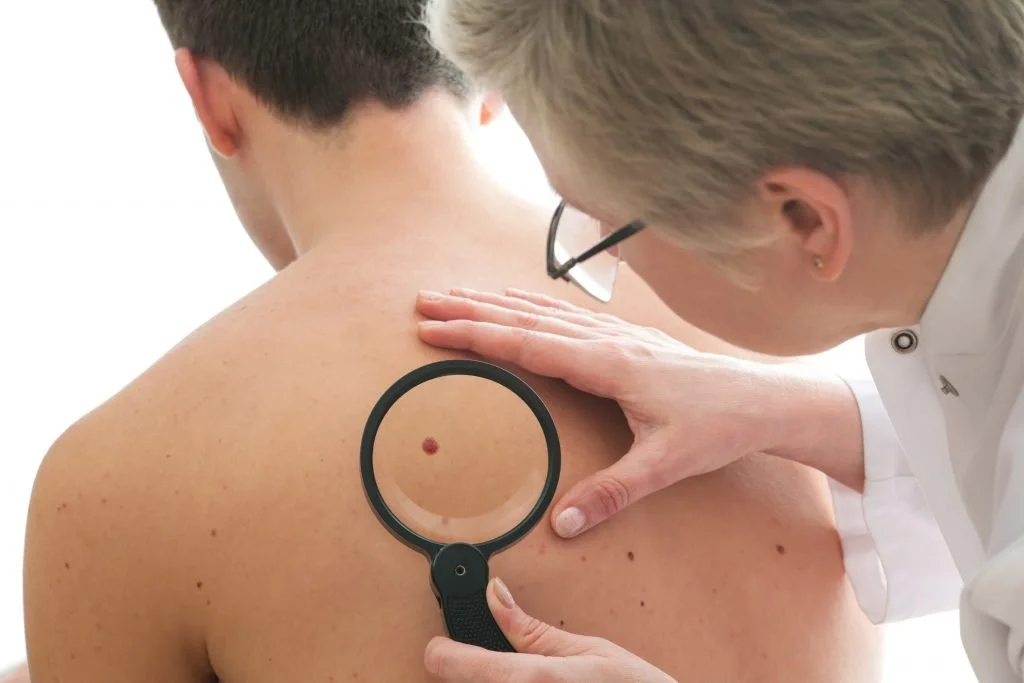 Skin Examination