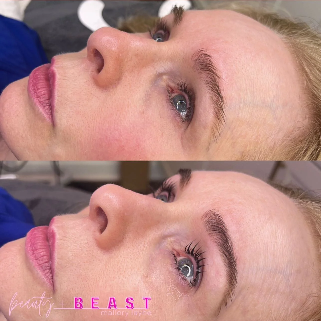 Brow Transformation + Lash Lift and Tint🩷

𝓛𝓲𝓷𝓴 𝓲𝓷 𝓑𝓲𝓸 𝓽𝓸 𝓑𝓸𝓸𝓴🔗📖

#beautybeast #mallorylayne #esthetician #esthetics #brows #browshaping #browtint #lash #lashlift #lashliftandtint #lashes #mandevillela