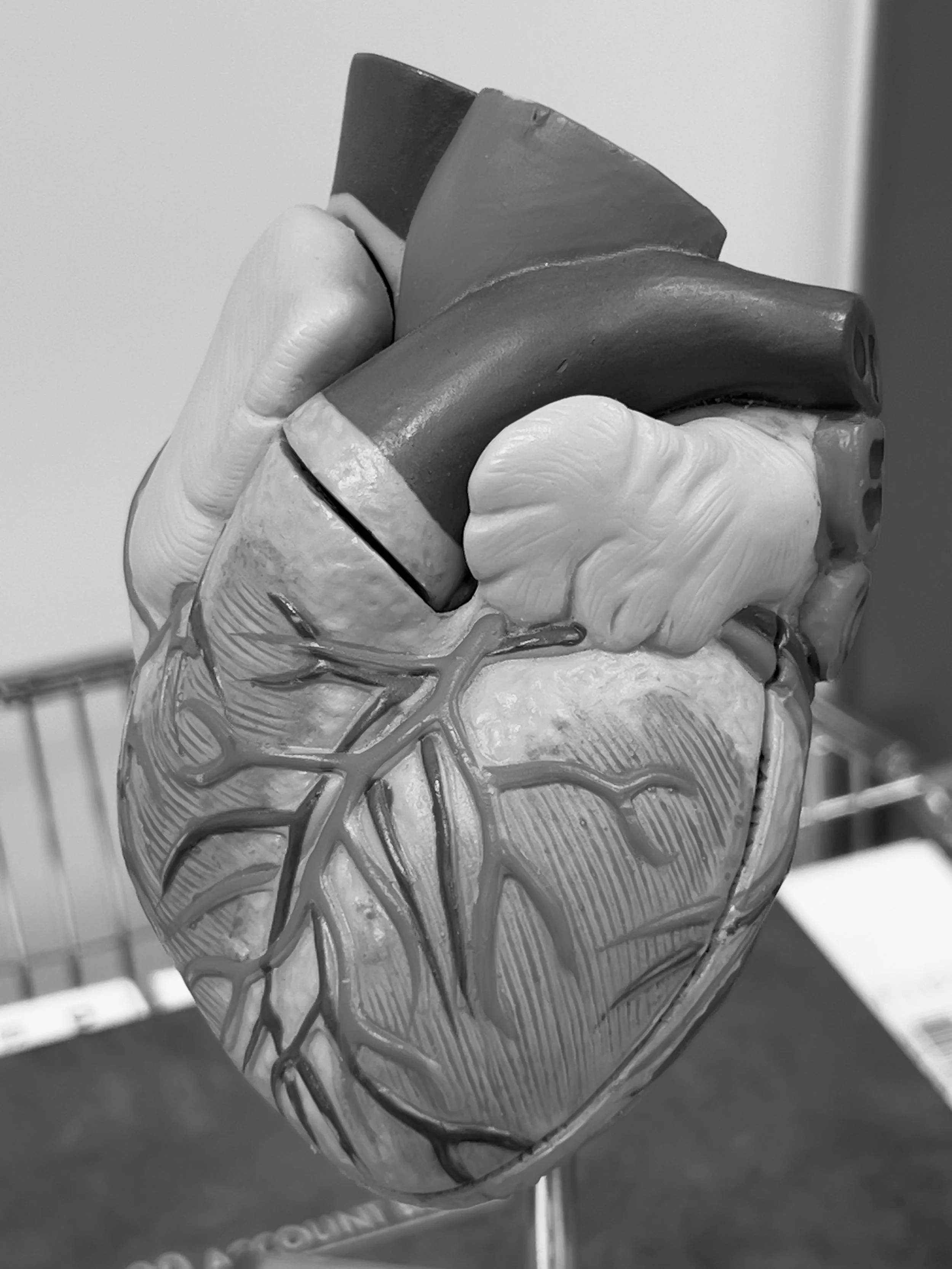 Anatomical heart model showing coronary arteries for surgery