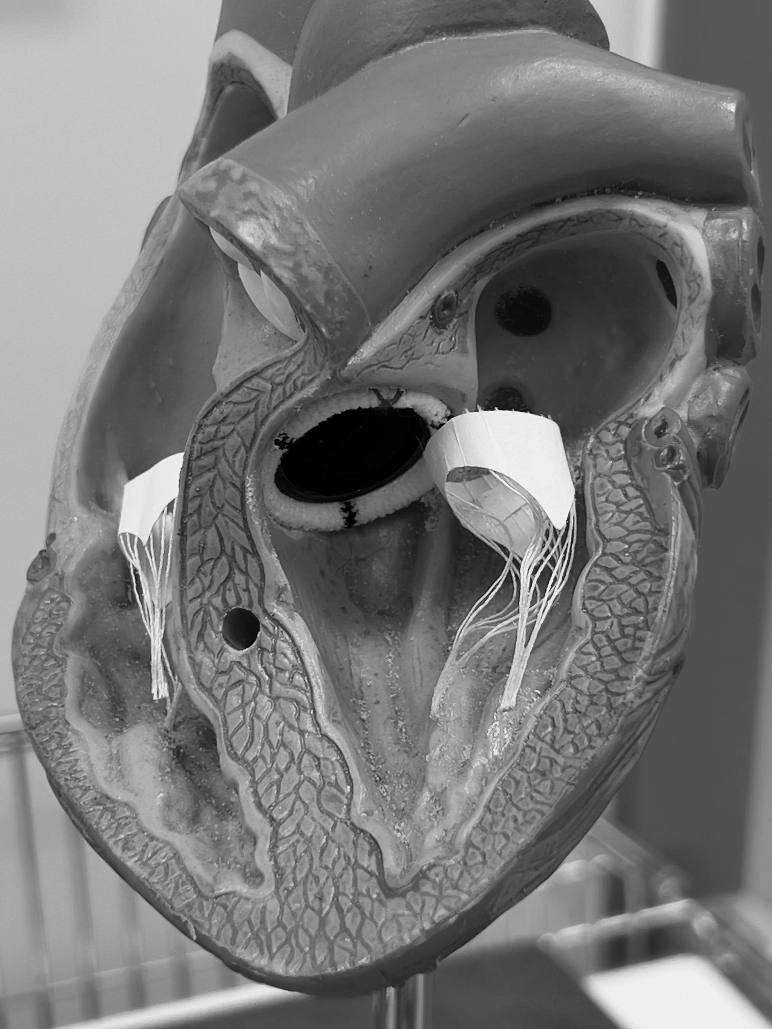 Anatomical heart model showing mitral and tricuspid valves for surgery