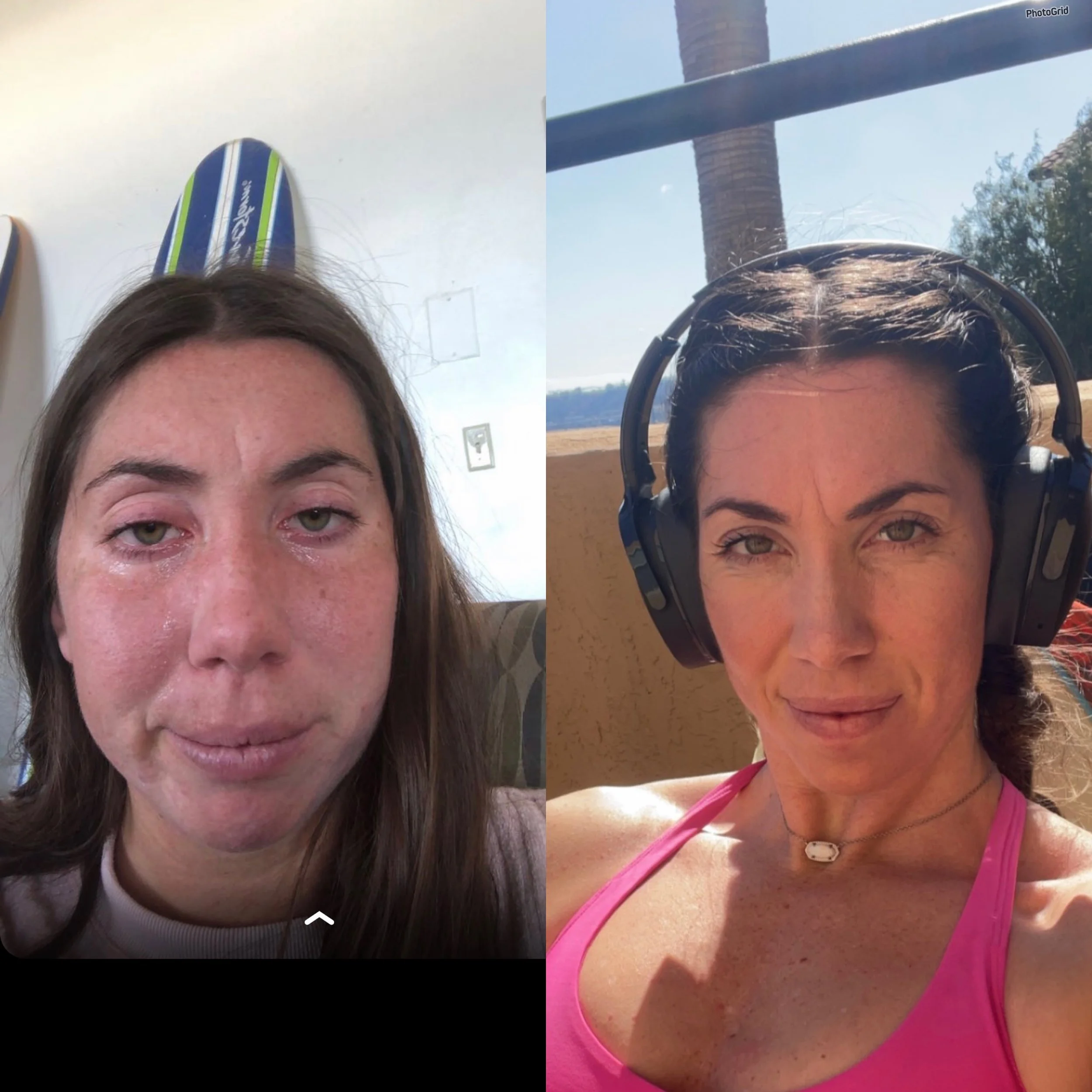 2019➡️2024
Ignore the tears lol came across this Snapchat memory from 5 years ago and was in SHOCK🤯
Nothing wrong with my wittle chipmunk face, but the lifestyle I have now is much healthier, and happier clearly lol✨

2019 ➡️ I was drinking alcohol 