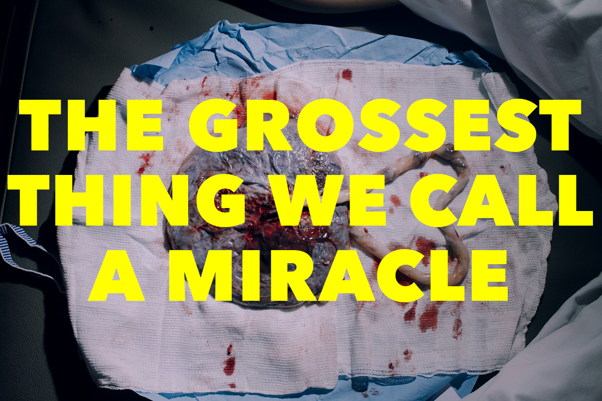 Poem: The Grossest Thing We Call a Miracle