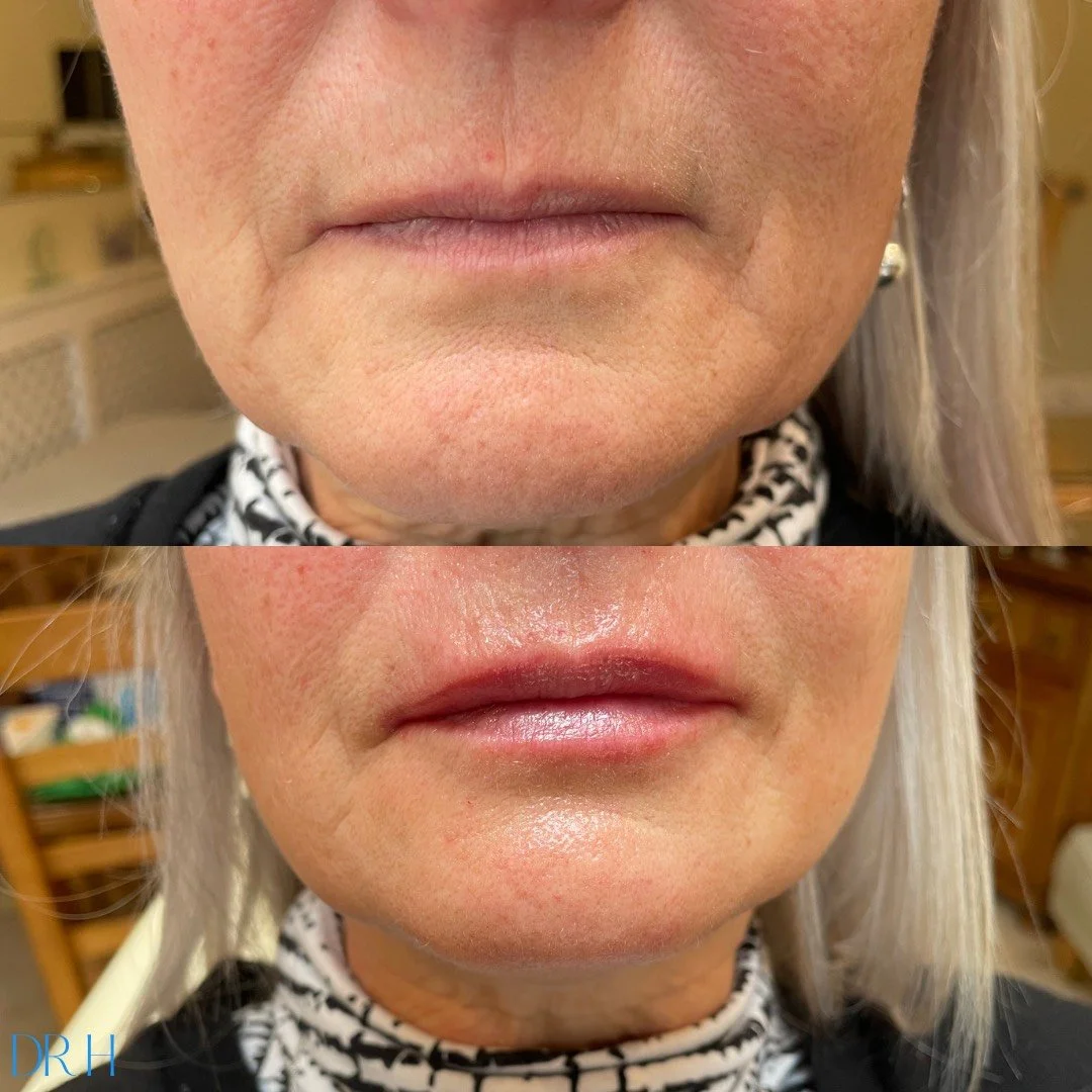 image_6483441 (2).JPG