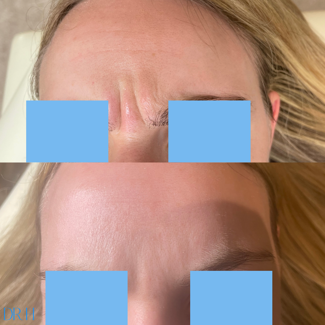 73FB35EB-410D-4D55-A832-D1F6BDB9730F (1).PNG