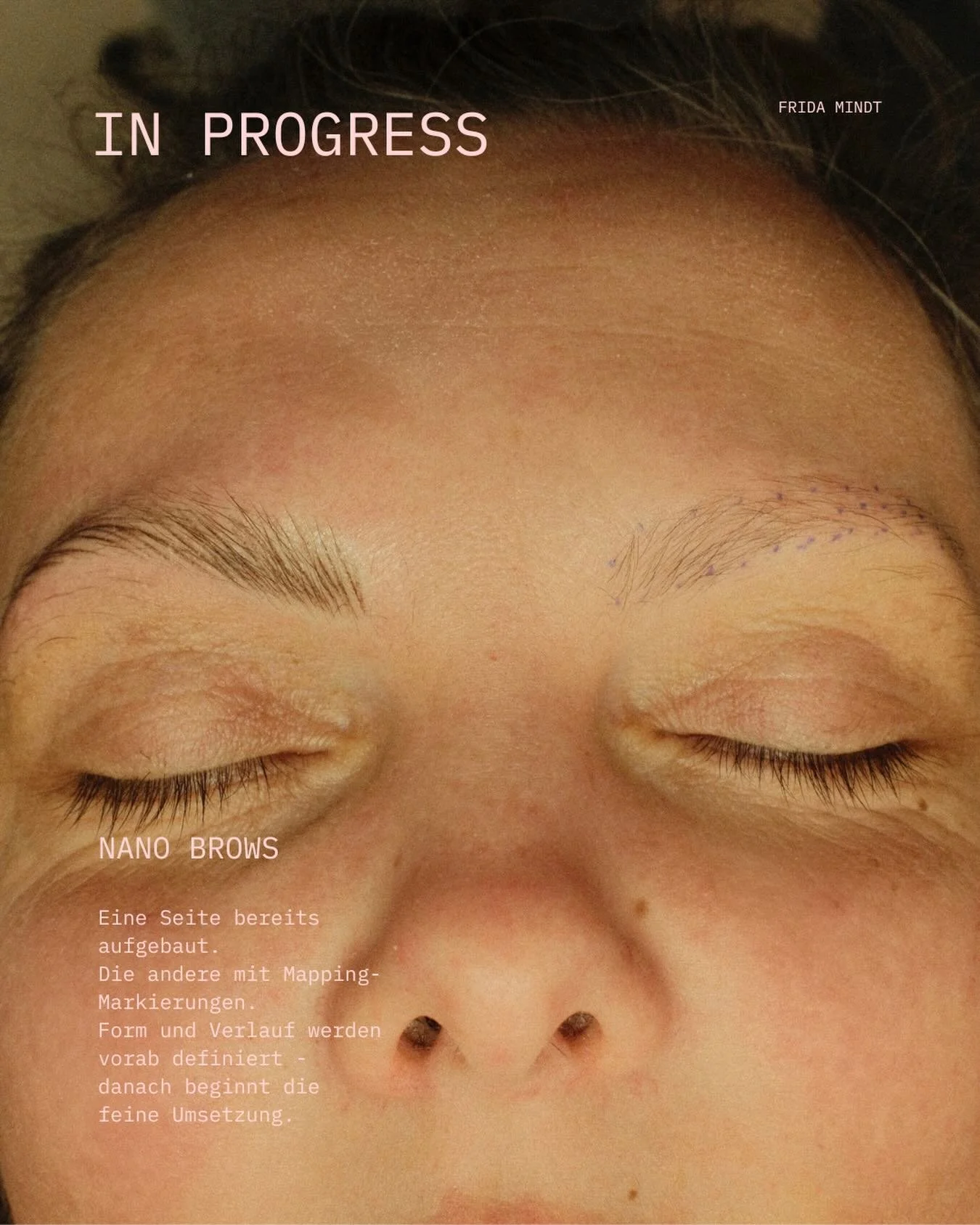 Nano Brows in progress.

Eine Seite ist bereits aufgebaut, die andere zeigt noch die Mapping-Markierungen.
Bevor ich beginne, wird die Form gemeinsam vor dem Spiegel festgelegt. Das Mapping dient dabei nicht als grobe Orientierung, sondern als pr&aum