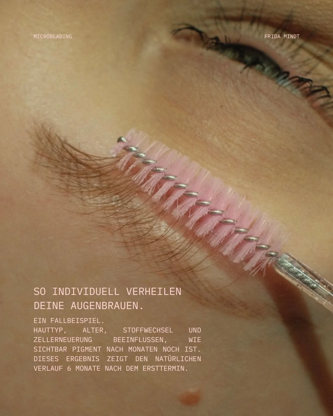 So individuell verheilen Augenbrauen.

Dieses Beispiel zeigt den Verlauf vom Ersttermin bis zum Touch-up.

Die Ausgangslage: sehr feine Eigenbrauen, kaum Definition im &auml;u&szlig;eren Bereich. Ziel war ein Aufbau in einer modernen, zur&uuml;ckhalt