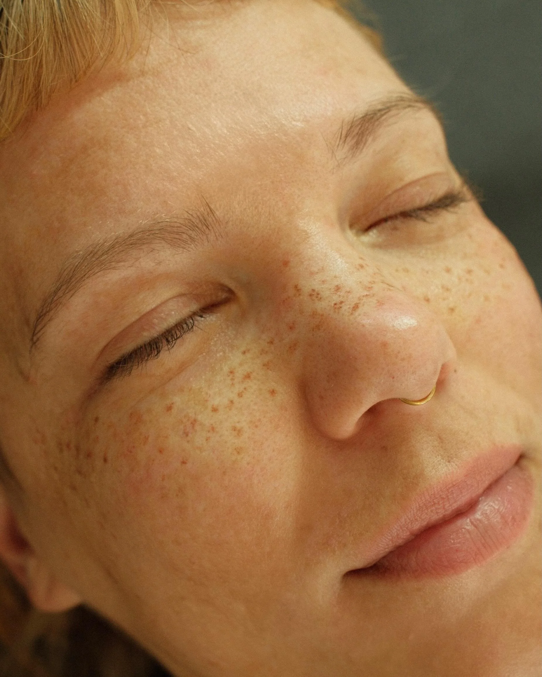 Freckles Light coverage