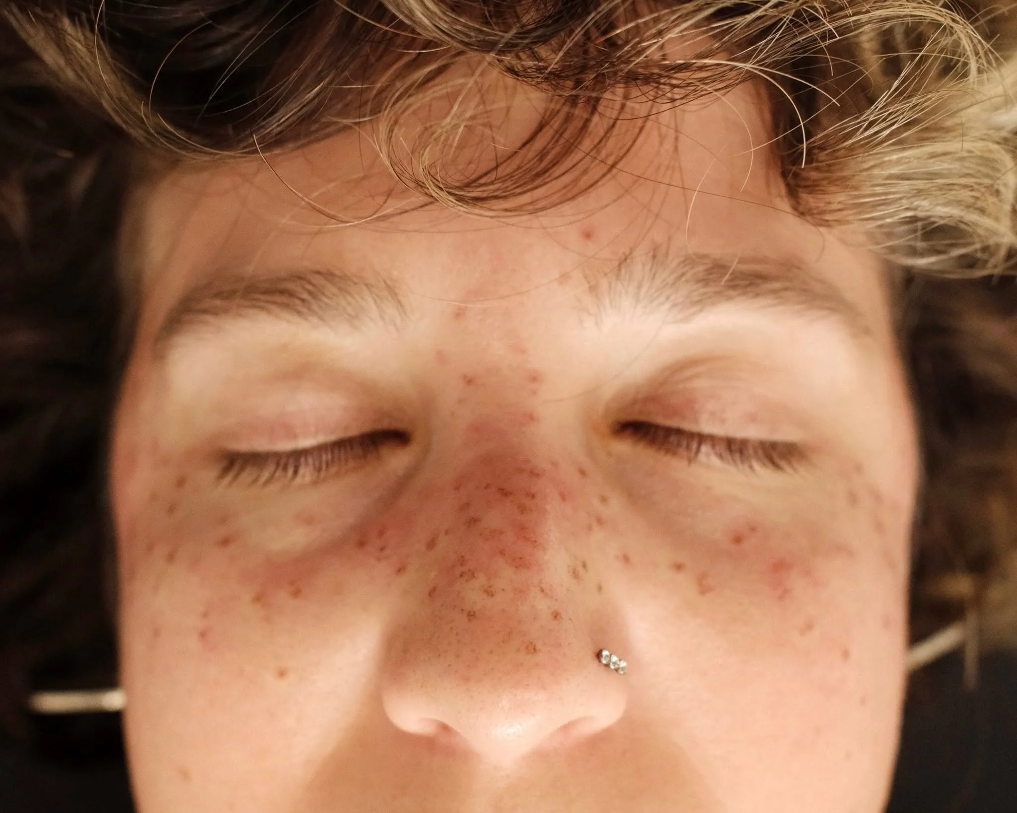 Light Coverage Freckles.

Bei Faux Freckles gibt es drei Coverage Level: Light, Medium und Heavy. 
Sie unterscheiden sich vor allem in der Dichte und darin, wie gro&szlig;fl&auml;chig die Freckles verteilt werden.

Light Coverage hat eine lockere Dic