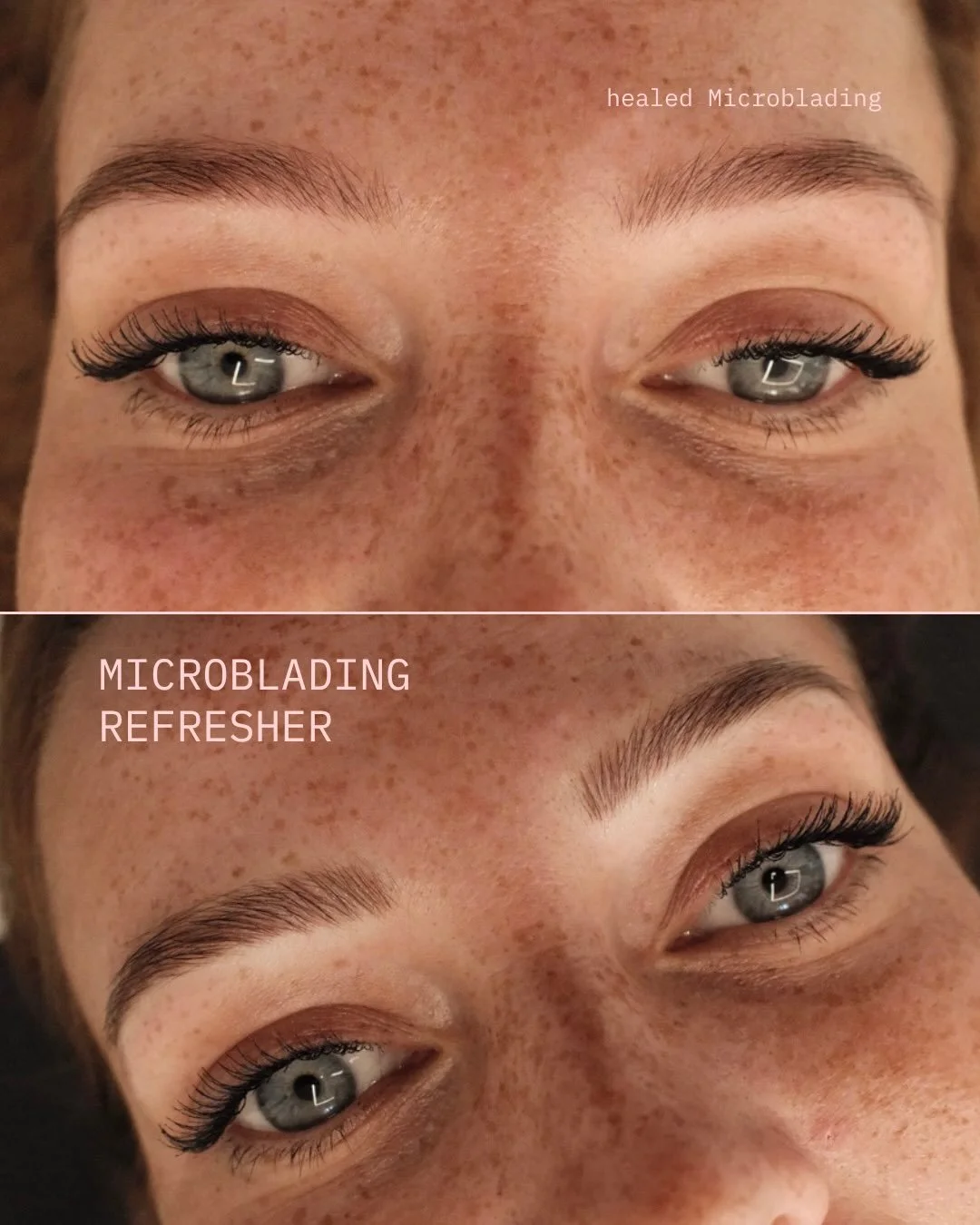 Microblading Refresher nach 2,5 Jahren.
Auf den Vorher-Bildern sieht man, wie sch&ouml;n das urspr&uuml;ngliche Microblading &uuml;ber die Jahre verblasst ist. Die einzelnen H&auml;rchen sind weicher und heller geworden, ohne dass eine kompakte Farbf
