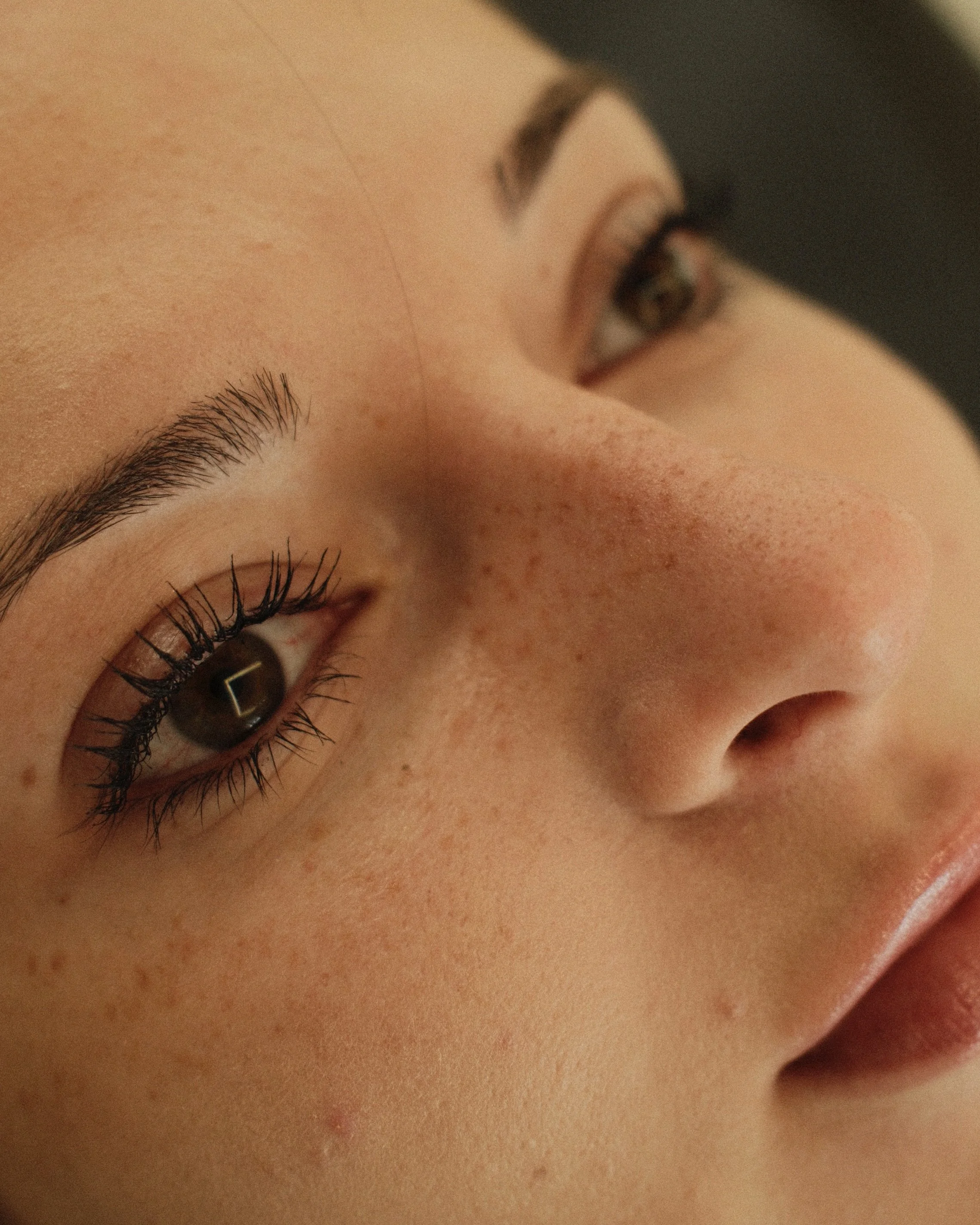 Freckles Tattoo Hamburg – zarte Sommersprossen