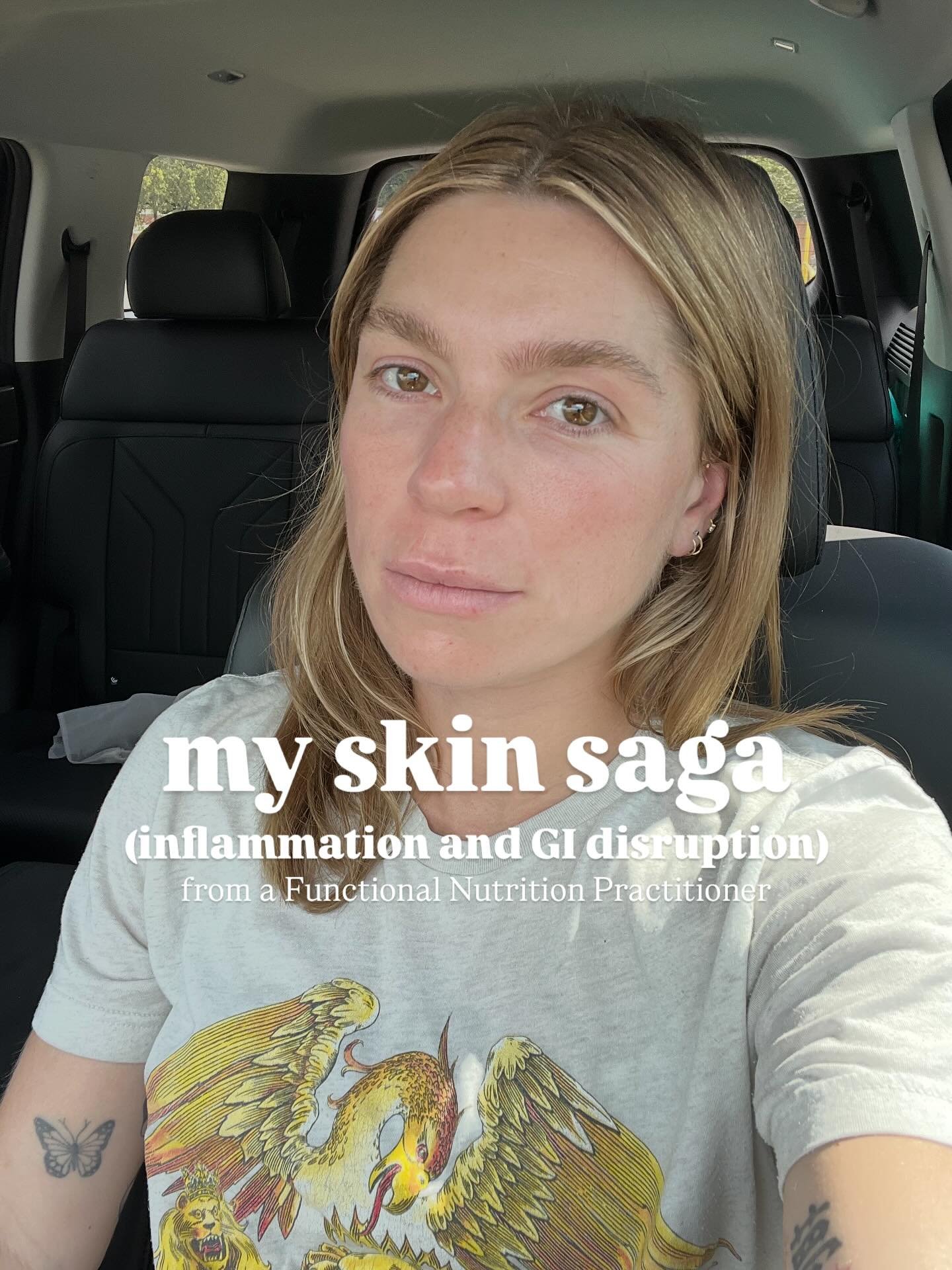 Finally sharing my skin saga from the past 1.5 months ✨ A reminder that healing isn&rsquo;t linear, your body is always talking, and the answers are often simpler than we think.

In functional health, skin is seen as a reflection of what&rsquo;s happ