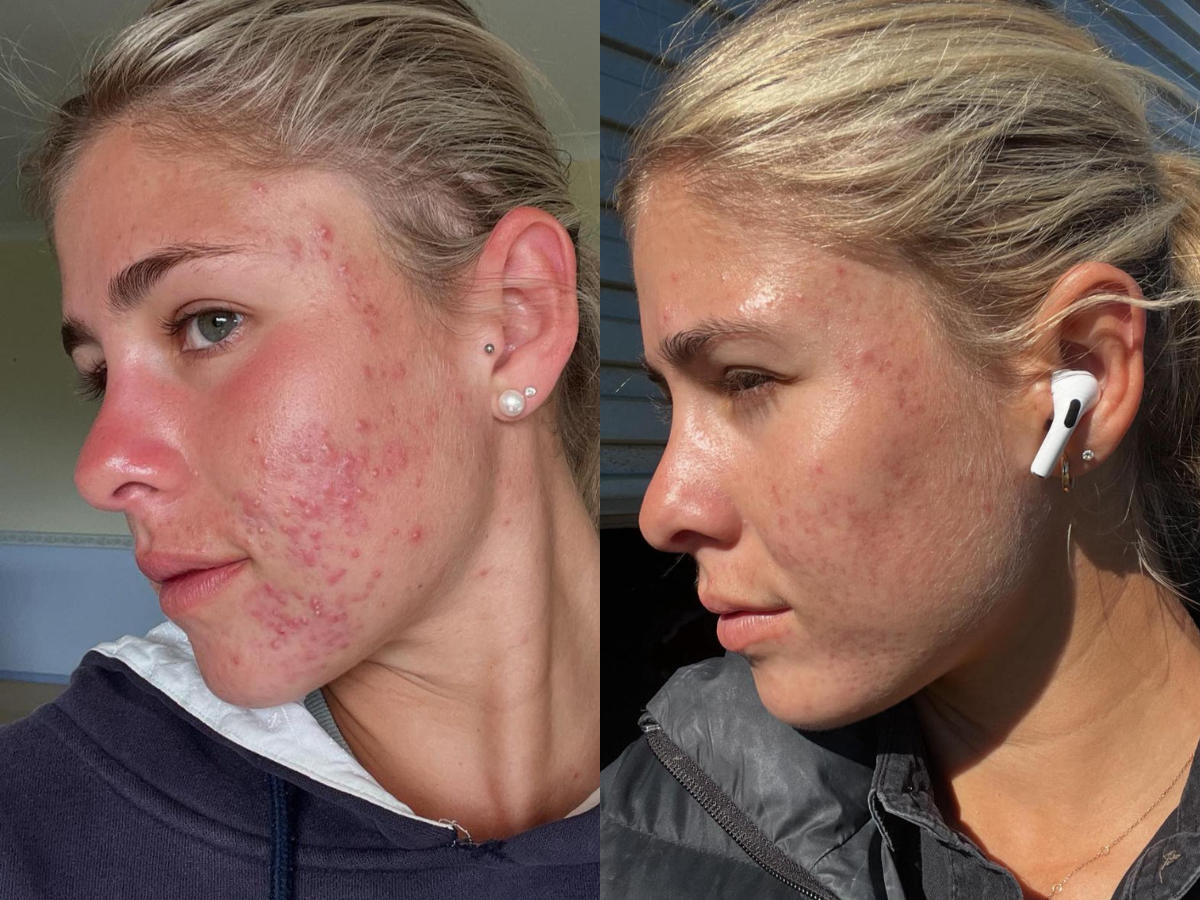 Transformation Images.png