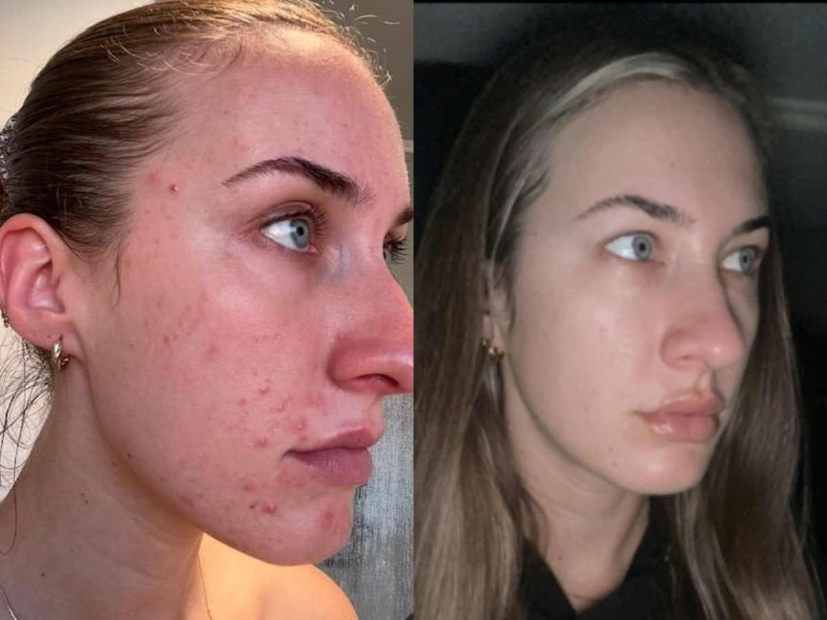 Transformation Images (2).png