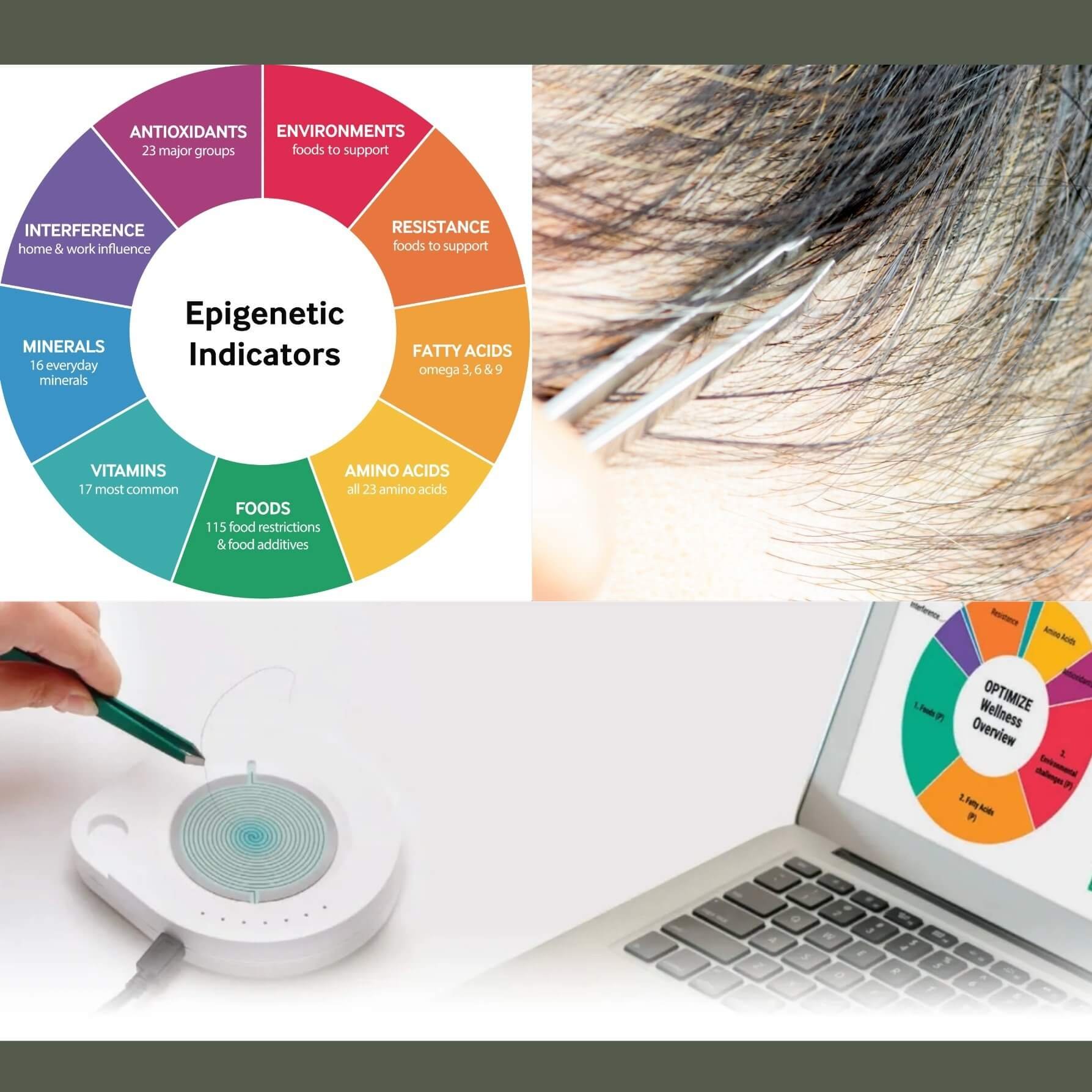 “Epigenetic test device and printed results used by Suzi Watkins, Board Certified Trichologist specializing in hair restoration, hair loss, and thinning hair, at Root Revival Hair Restoration in Cumming GA.”