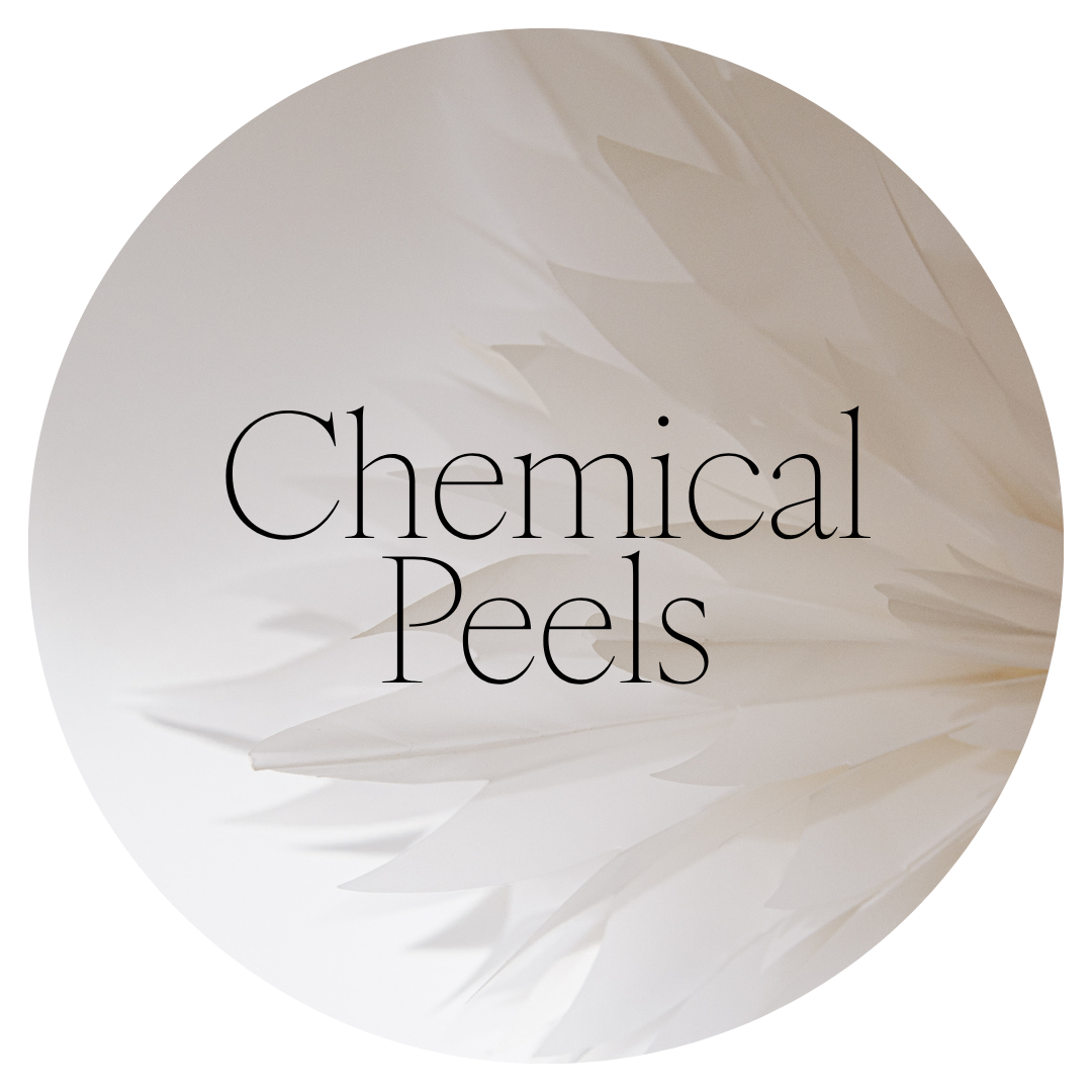 Close-up of a white feather with text overlaid that reads 'Chemical Peels'.