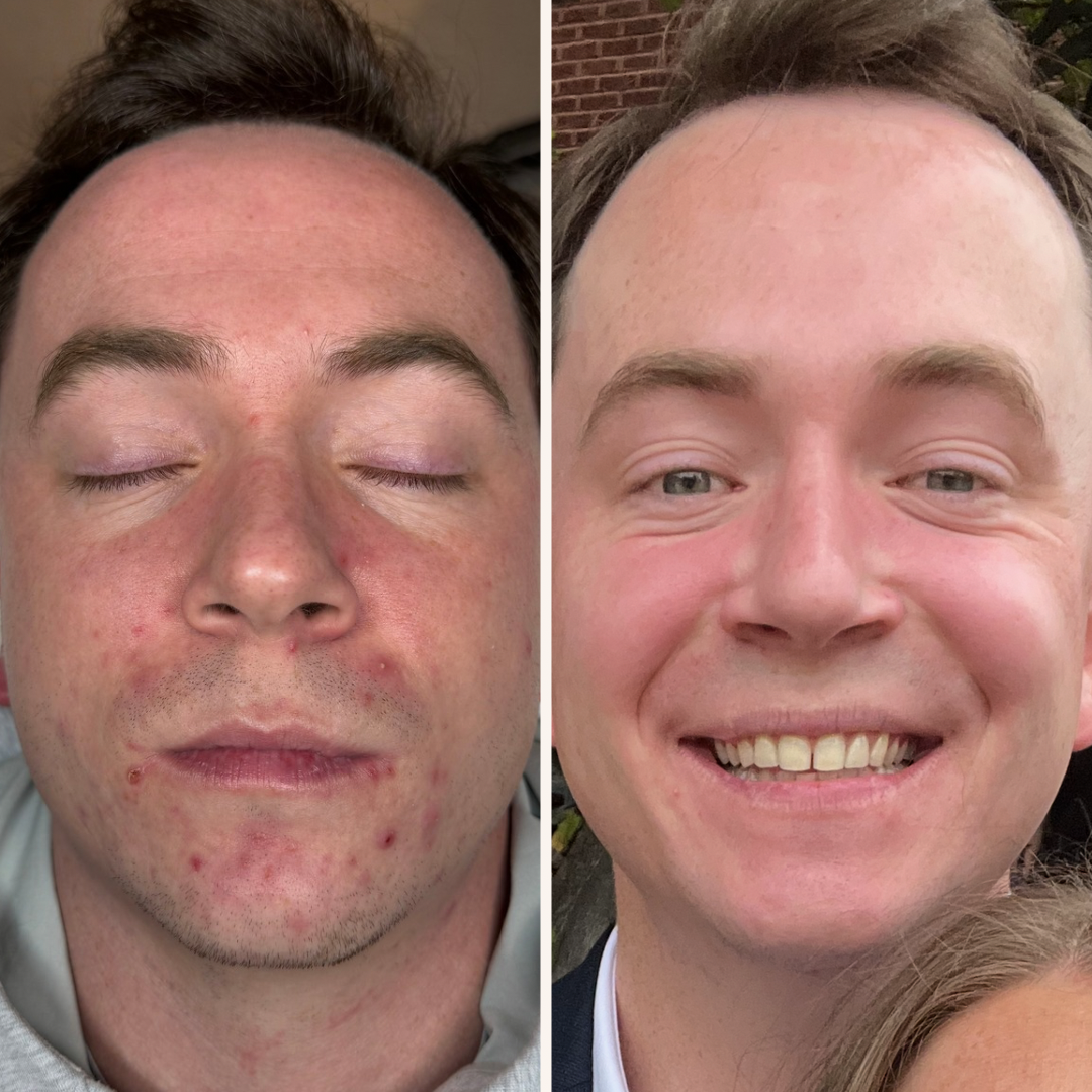 Minimalist Modern Before After Beauty Instagram Post.PNG